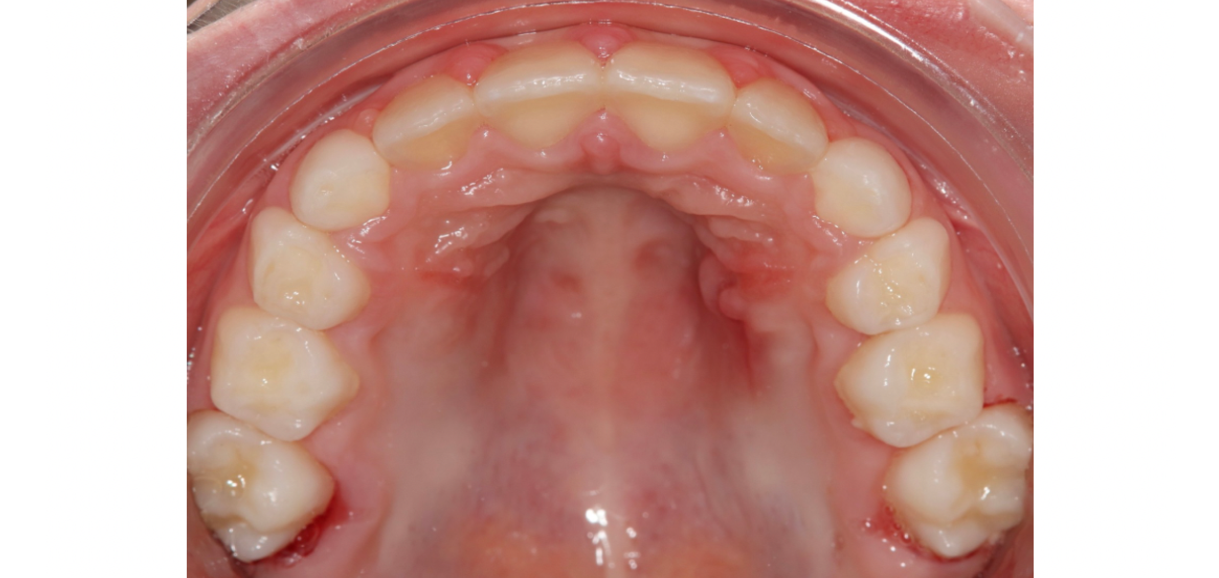 Exemples de cas traités par le Dr Quentin Boison