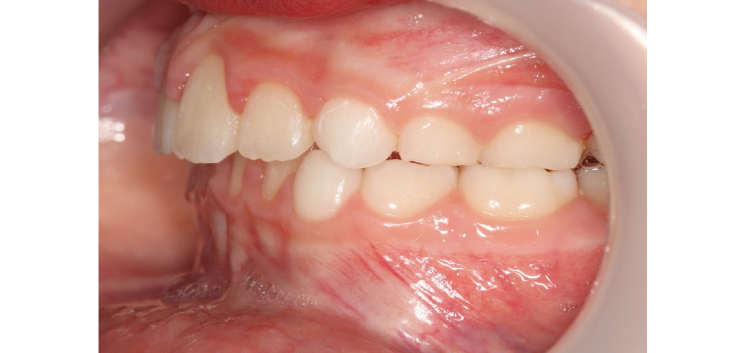 Exemples de cas traités par le Dr Quentin Boison