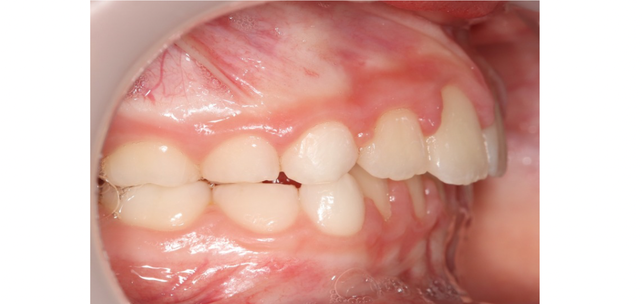 Exemples de cas traités par le Dr Quentin Boison