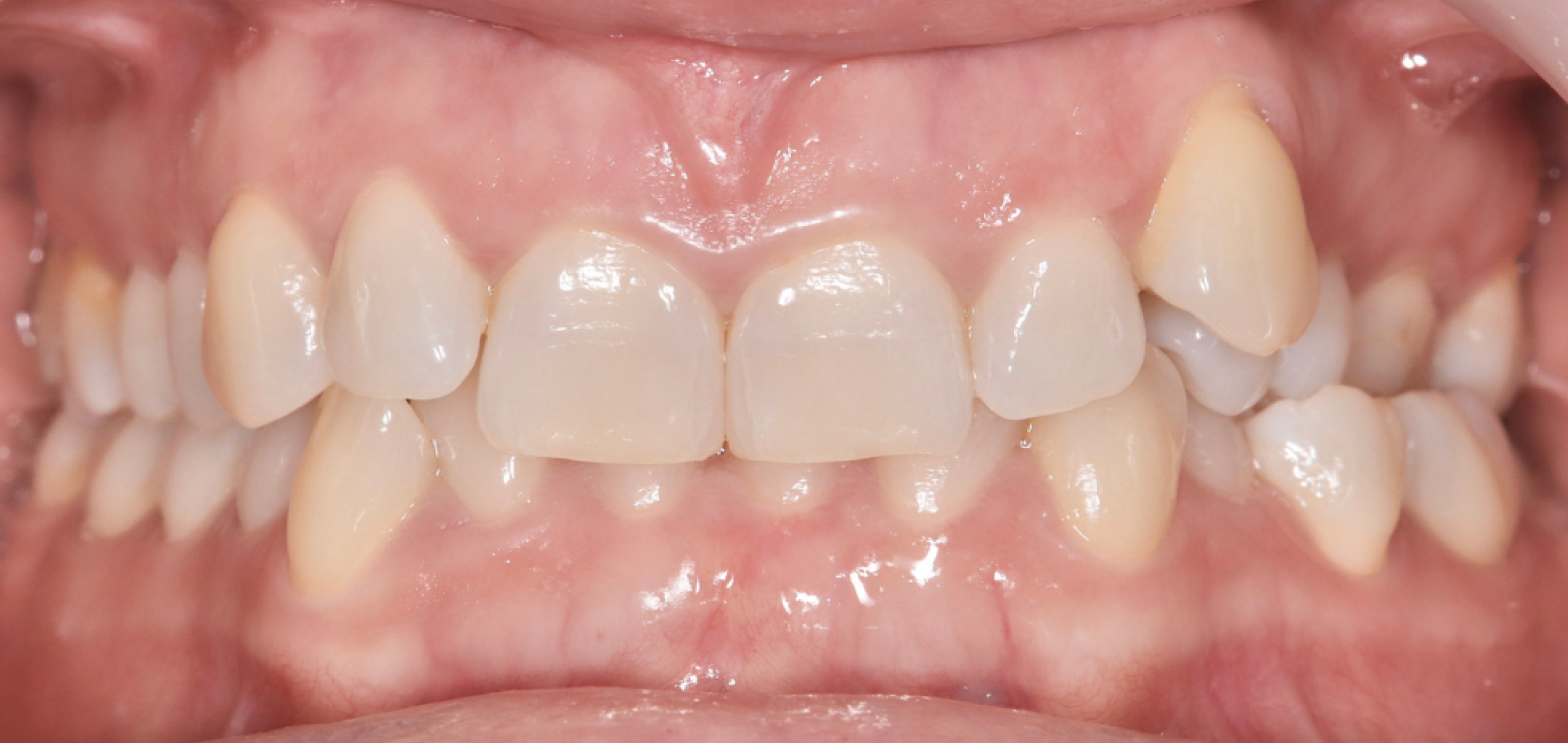 Exemples de cas traités par le Dr Quentin Boison