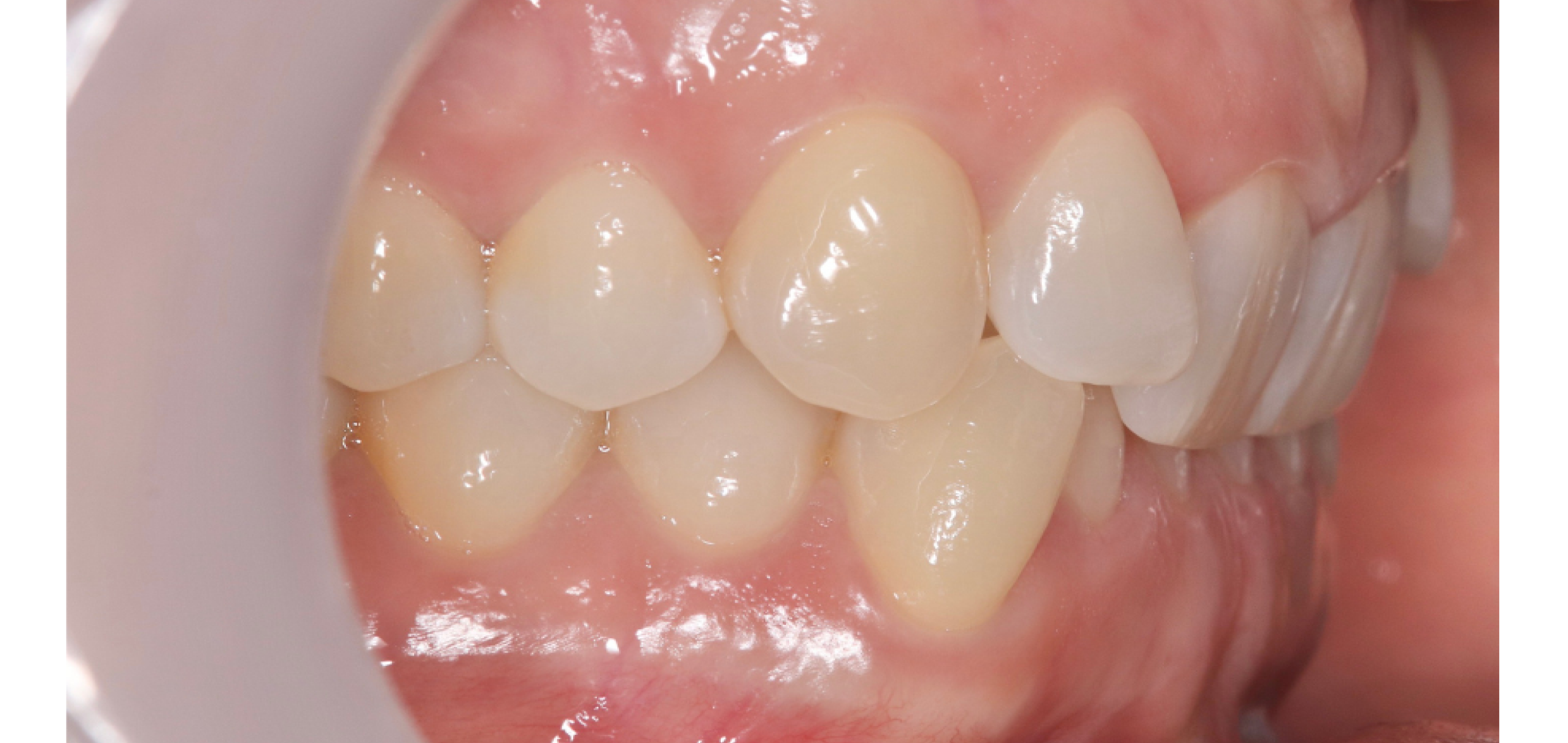 Exemples de cas traités par le Dr Quentin Boison