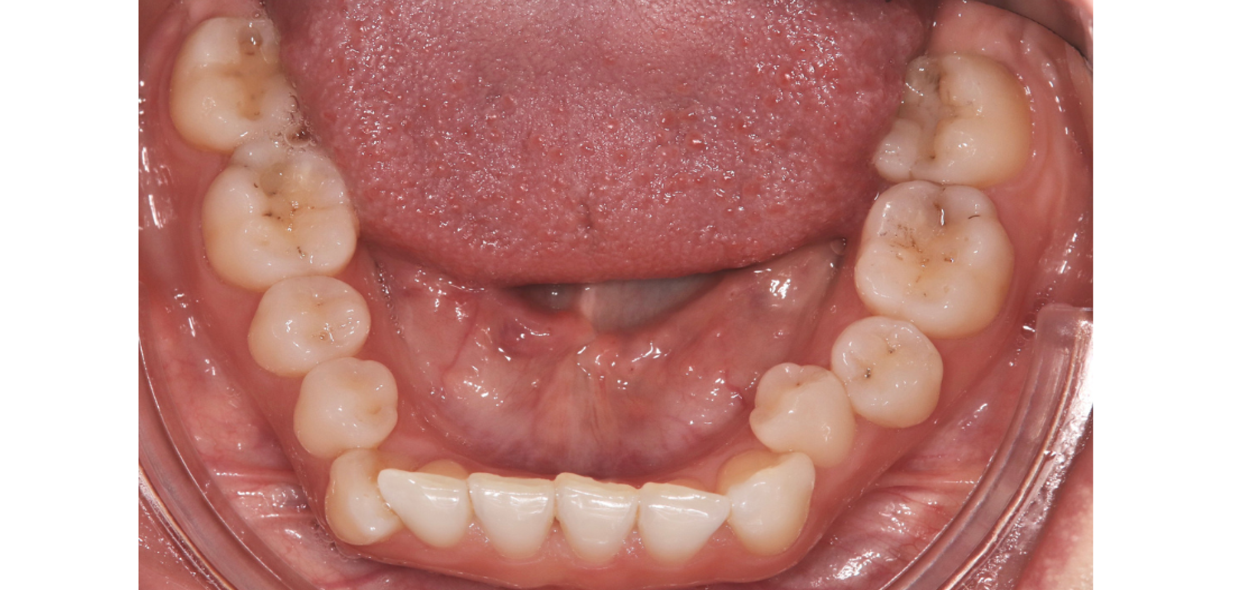 Exemples de cas traités par le Dr Quentin Boison