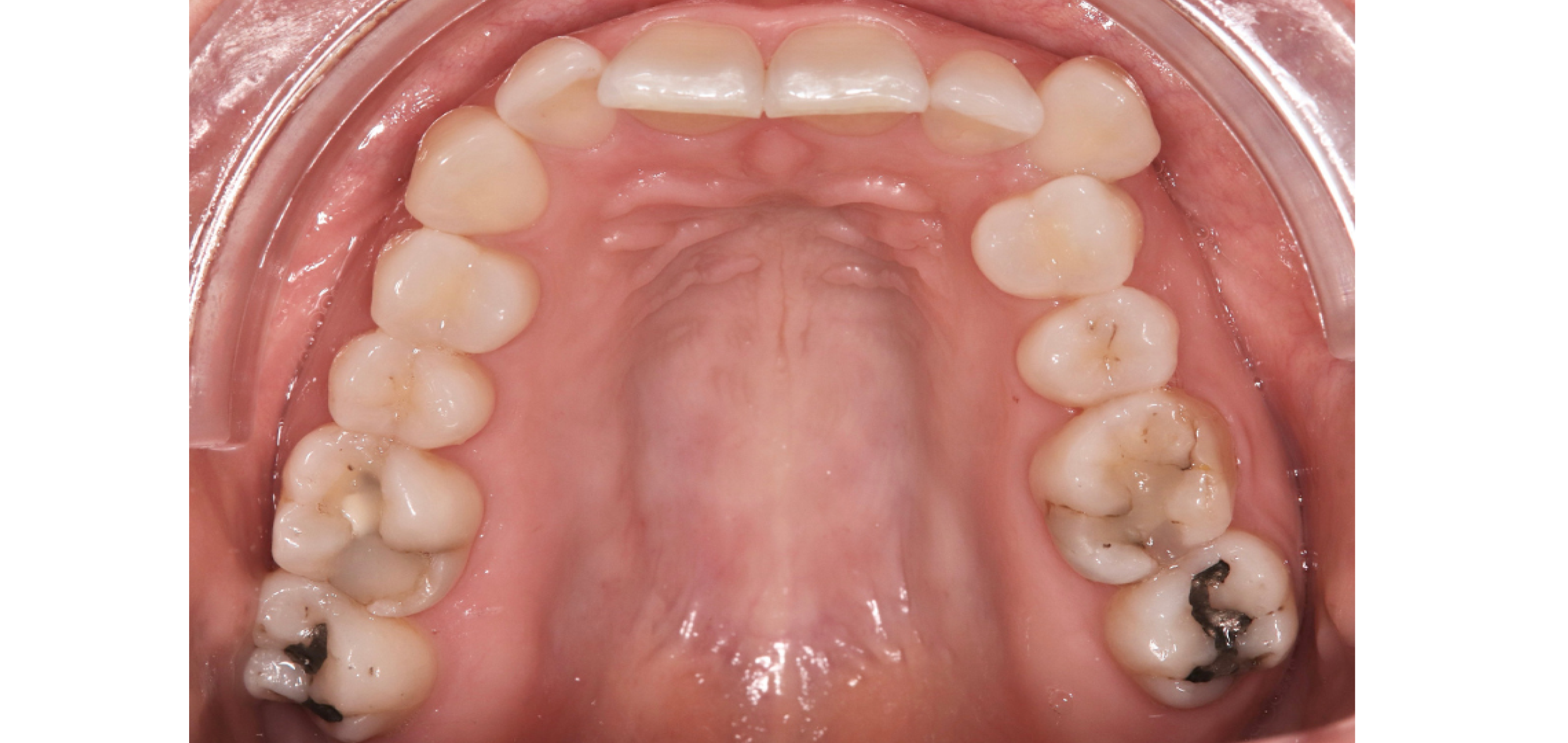 Exemples de cas traités par le Dr Quentin Boison