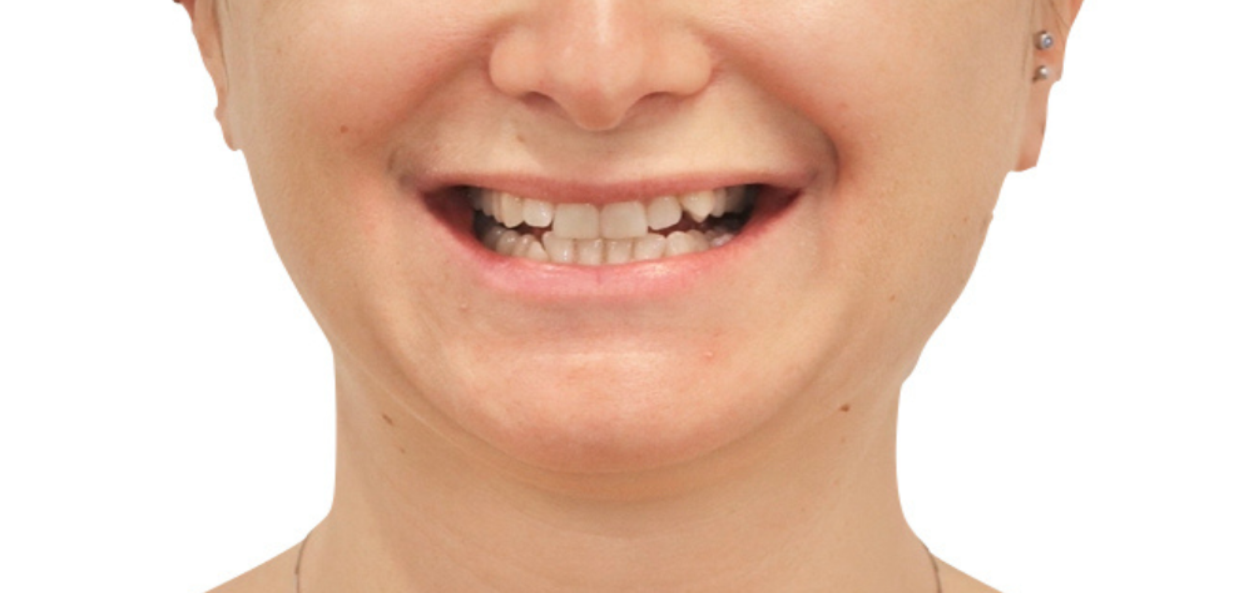 Exemples de cas traités par le Dr Quentin Boison