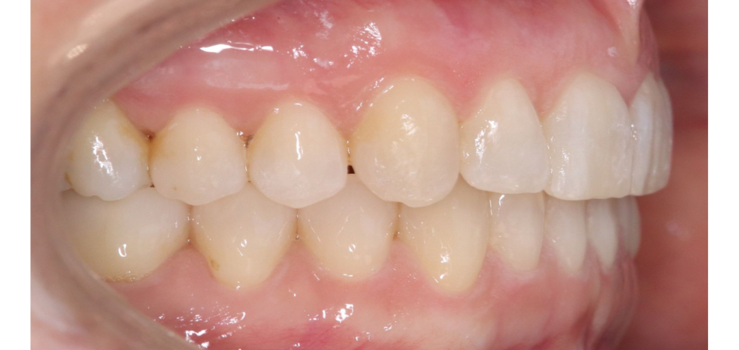 Exemples de cas traités par le Dr Quentin Boison