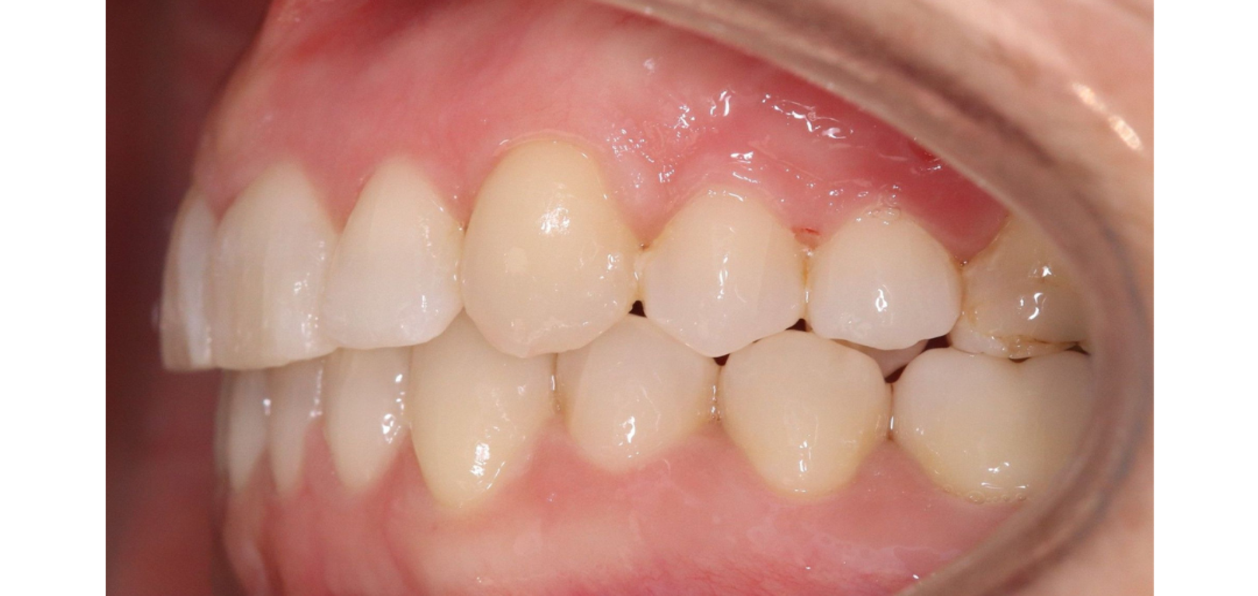 Exemples de cas traités par le Dr Quentin Boison