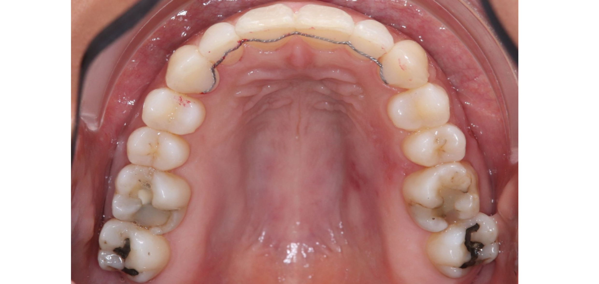 Exemples de cas traités par le Dr Quentin Boison