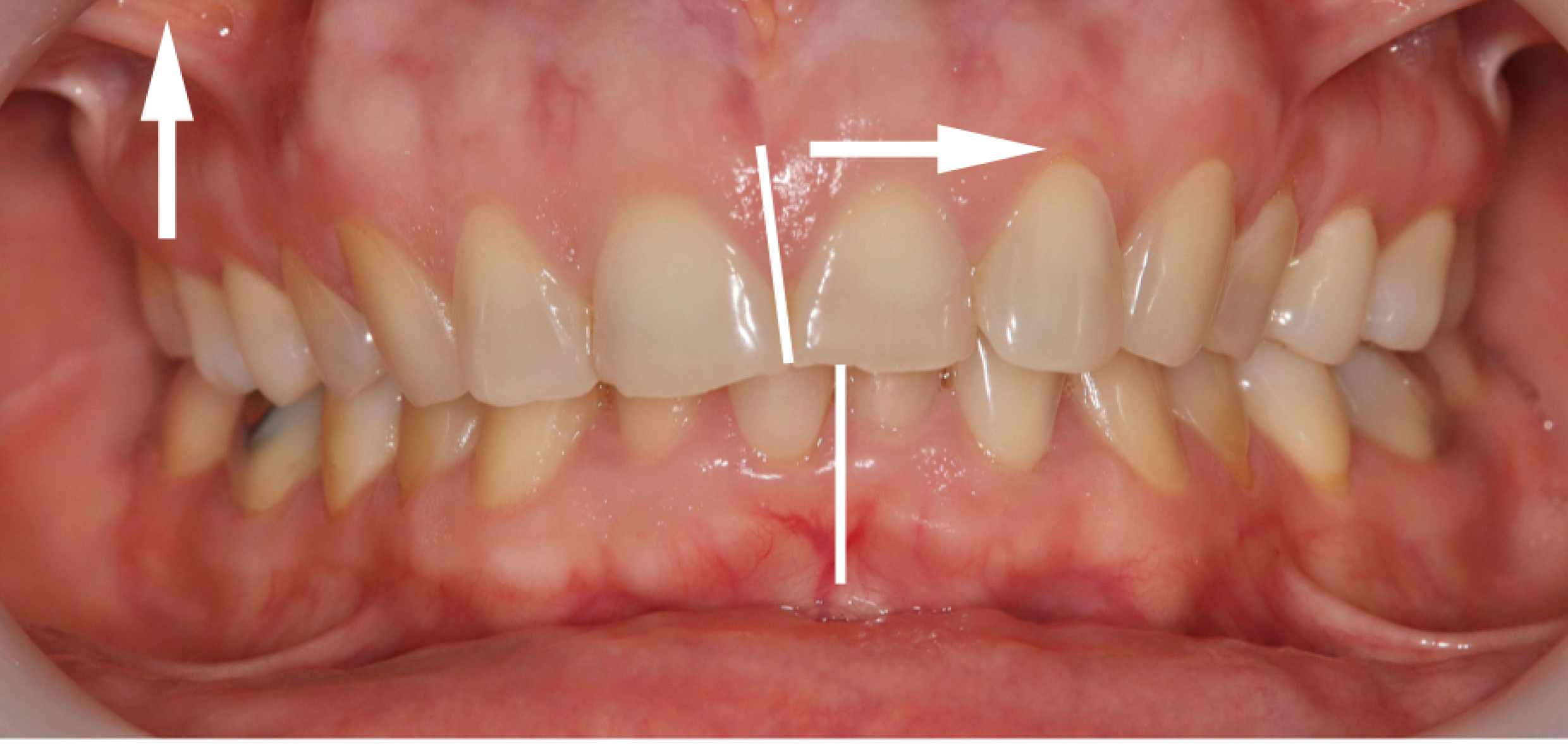 Exemples de cas traités par le Dr Quentin Boison