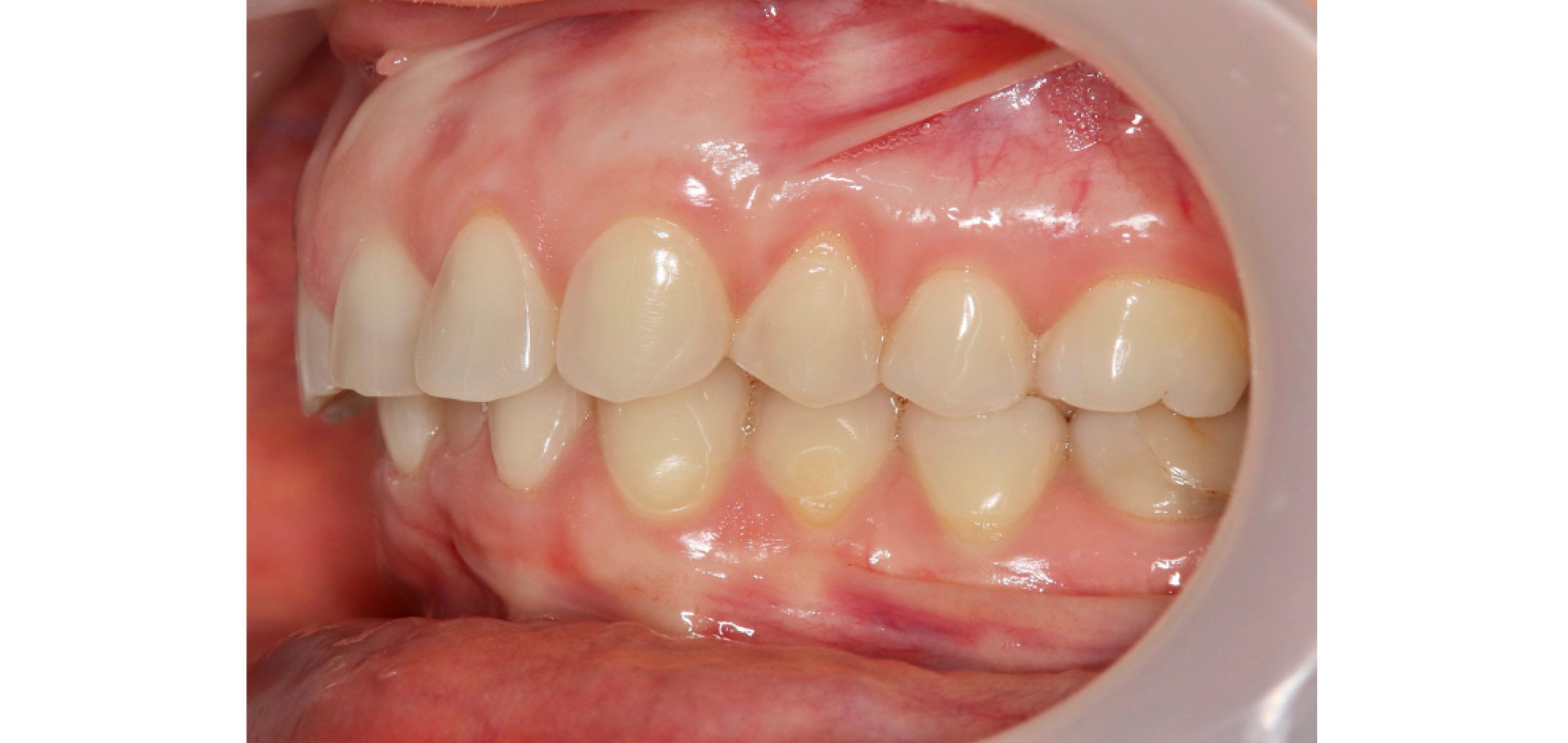 Exemples de cas traités par le Dr Quentin Boison