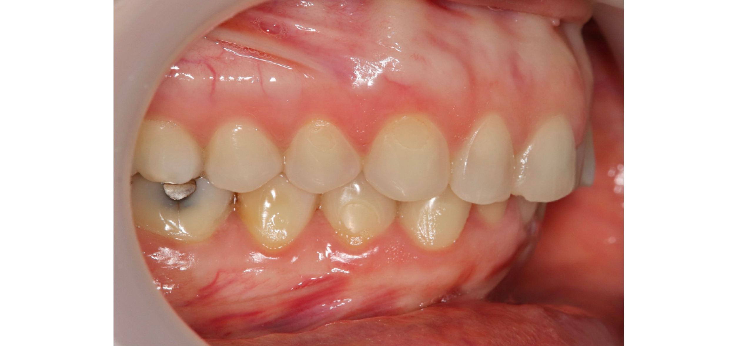 Exemples de cas traités par le Dr Quentin Boison