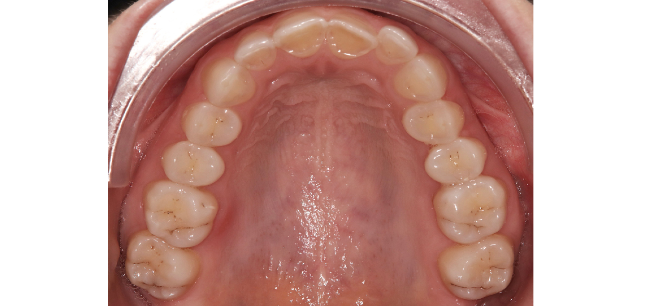 Exemples de cas traités par le Dr Quentin Boison