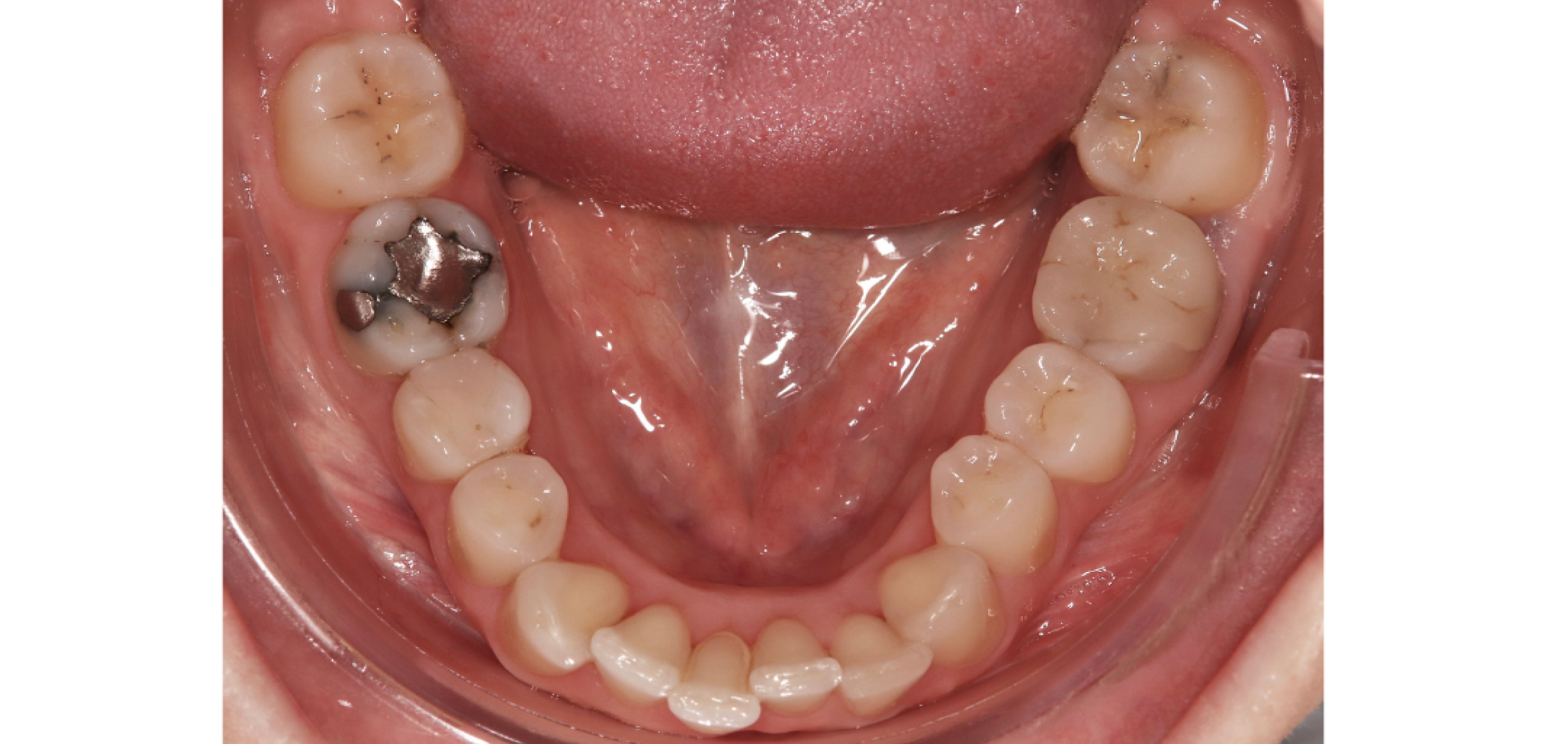 Exemples de cas traités par le Dr Quentin Boison