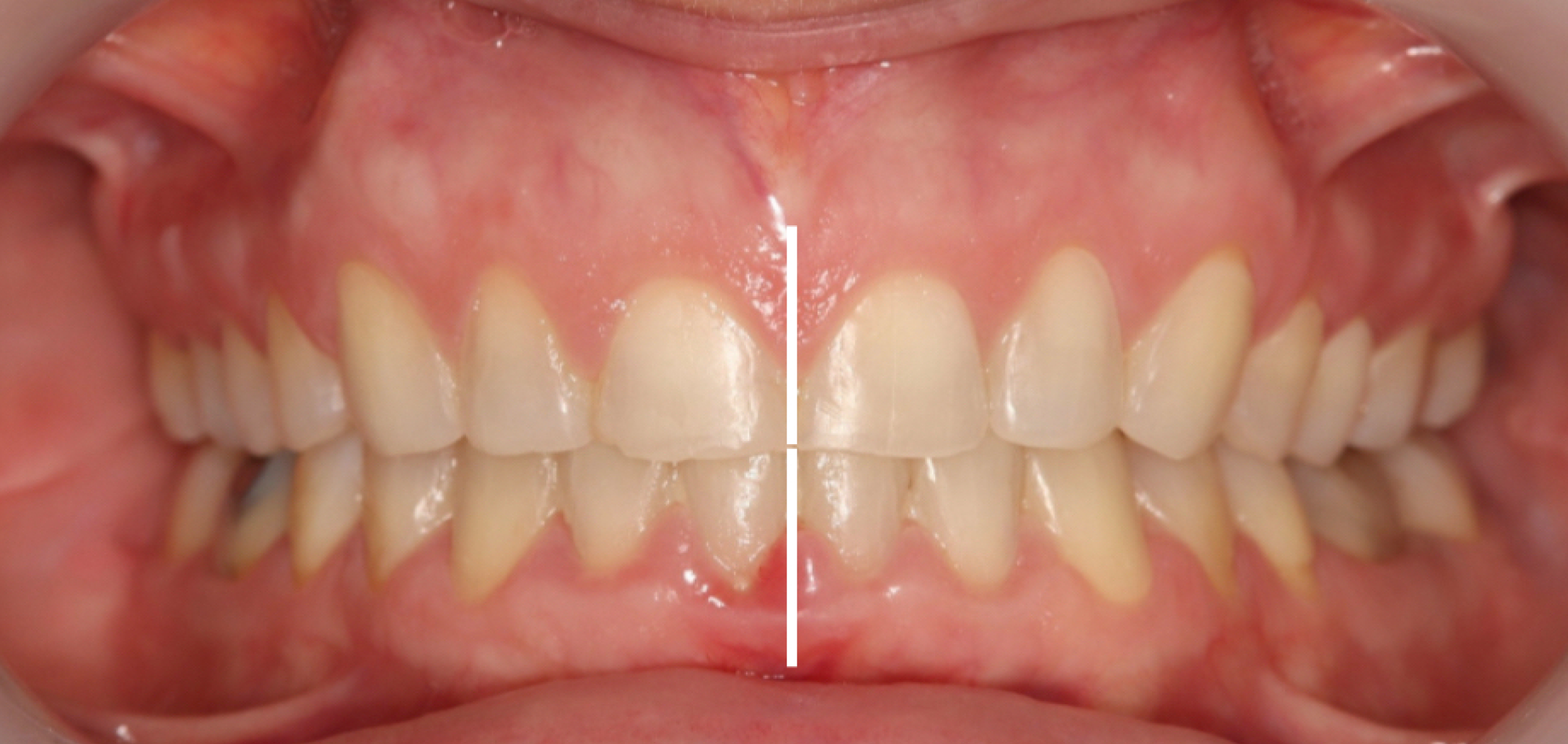 Exemples de cas traités par le Dr Quentin Boison