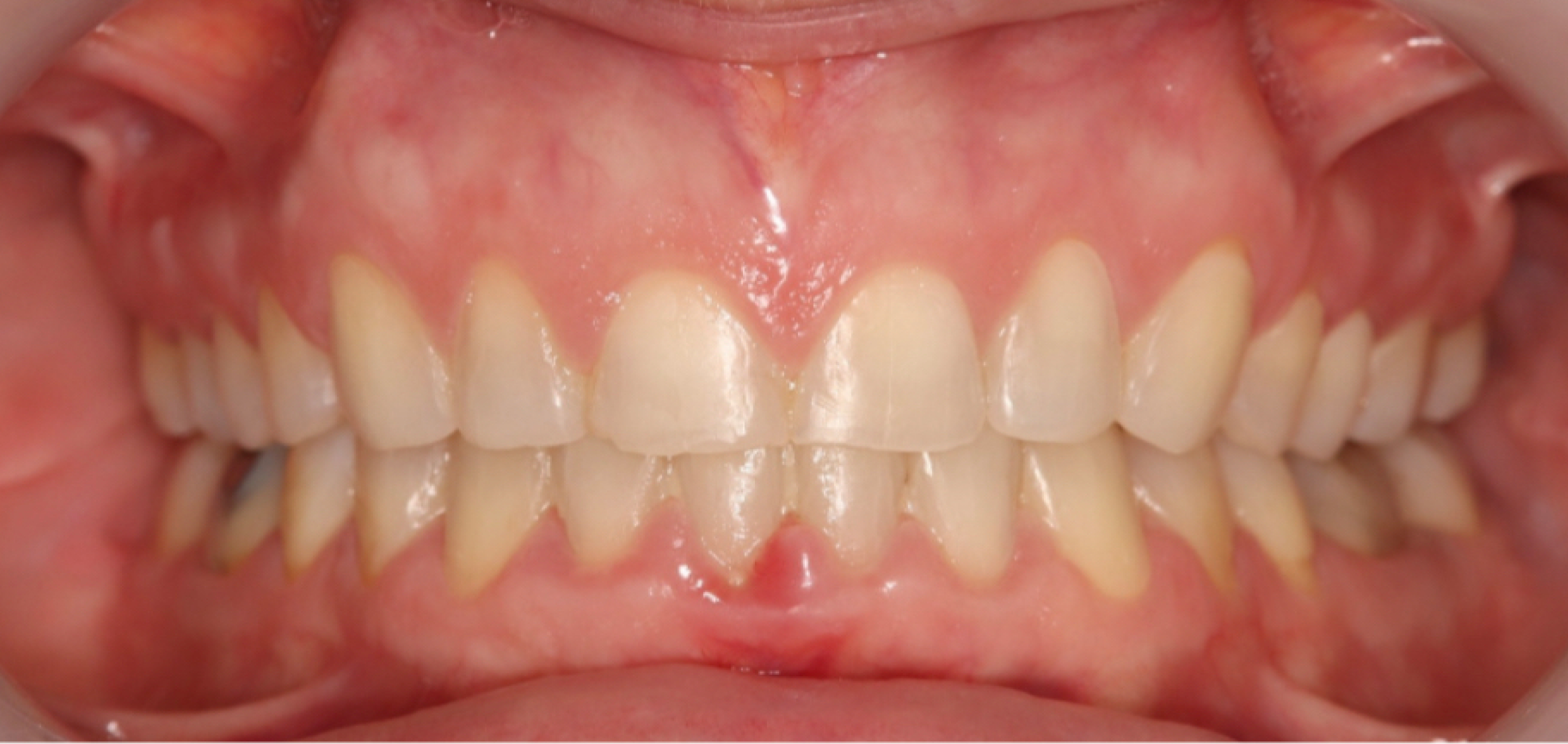 Exemples de cas traités par le Dr Quentin Boison