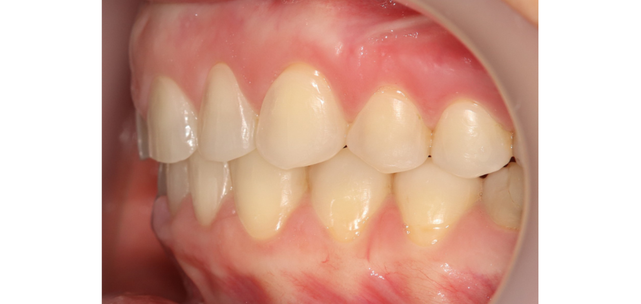 Exemples de cas traités par le Dr Quentin Boison