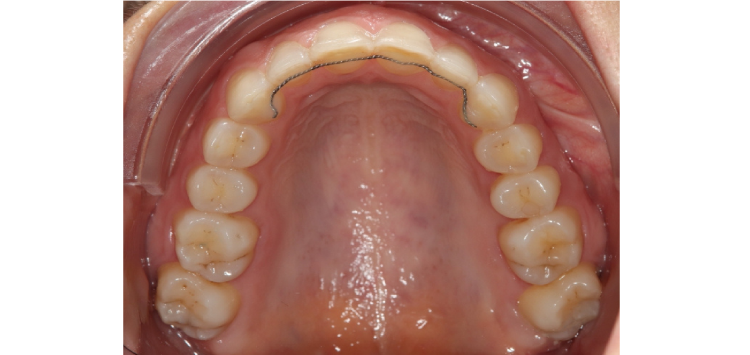 Exemples de cas traités par le Dr Quentin Boison