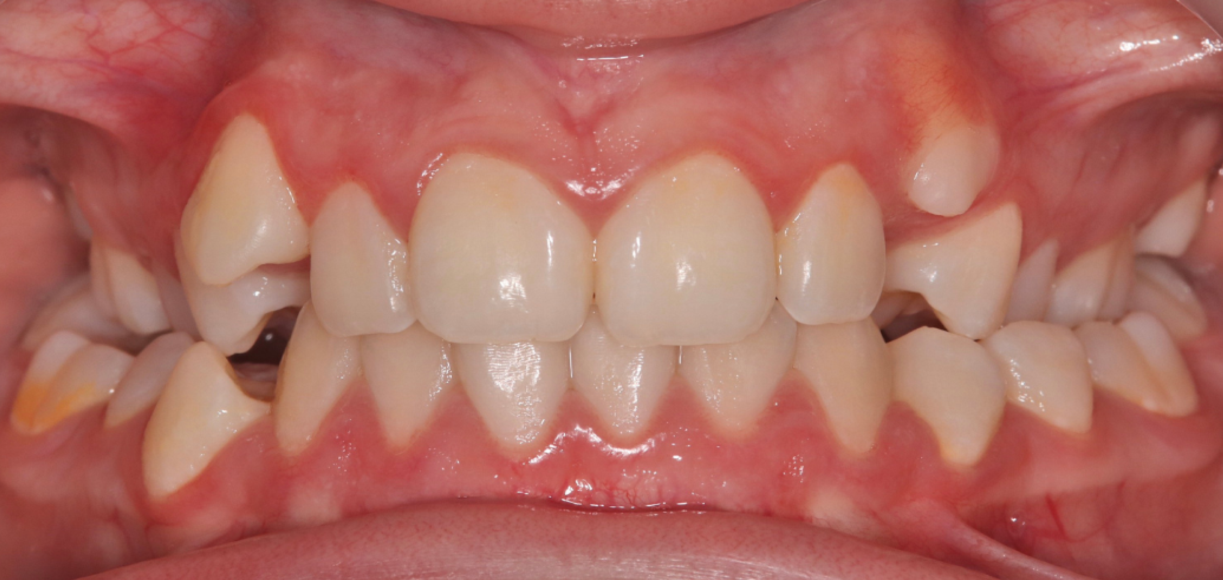 Exemples de cas traités par le Dr Quentin Boison