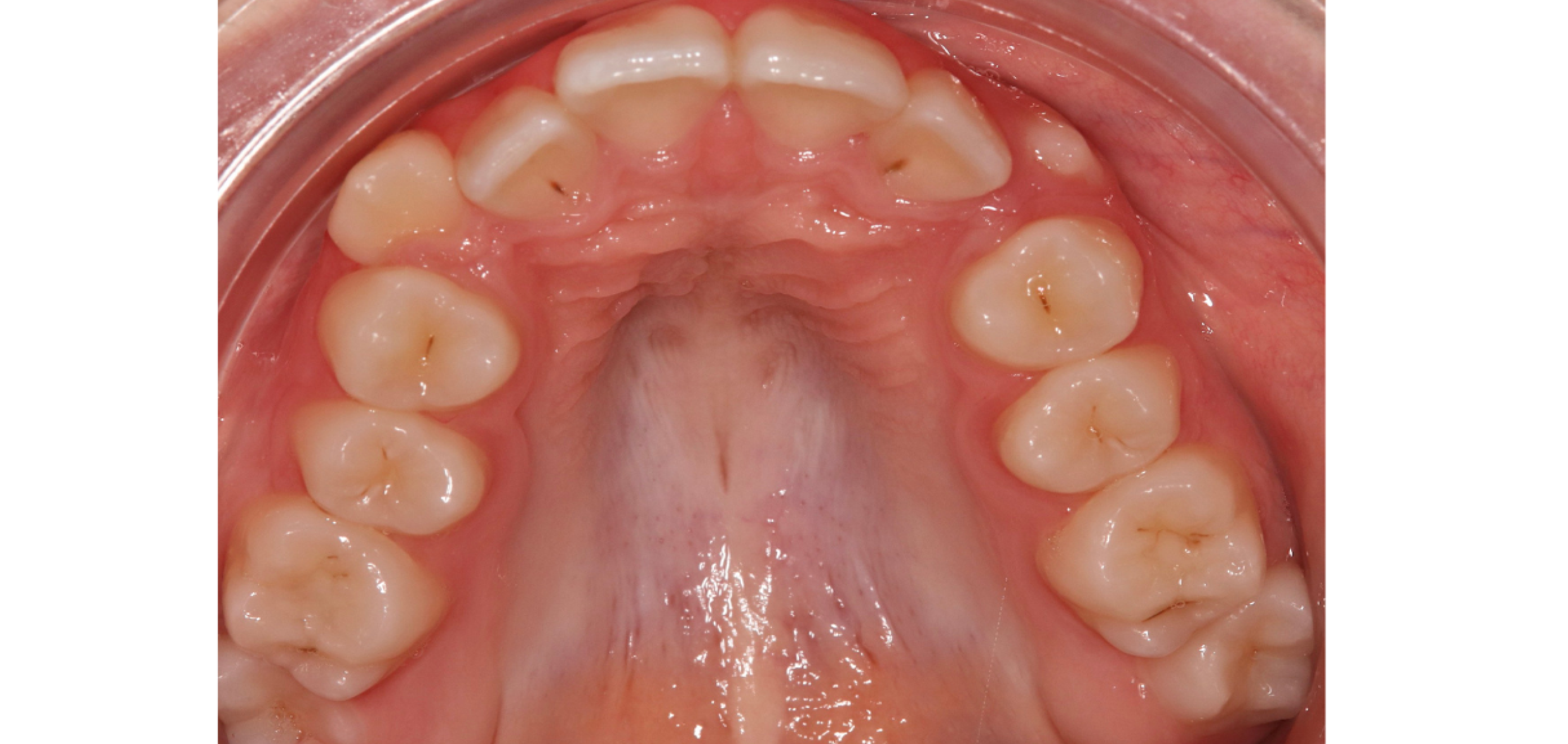 Exemples de cas traités par le Dr Quentin Boison