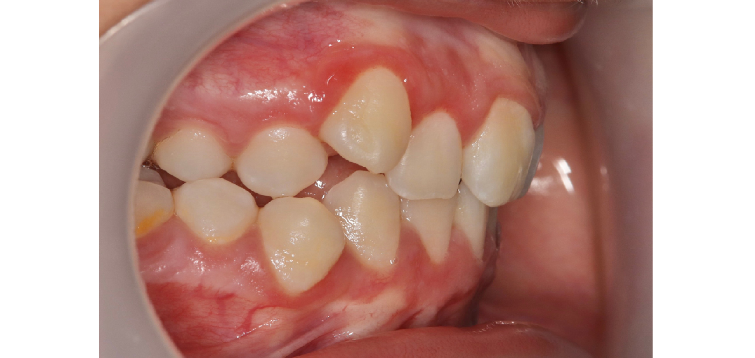 Exemples de cas traités par le Dr Quentin Boison