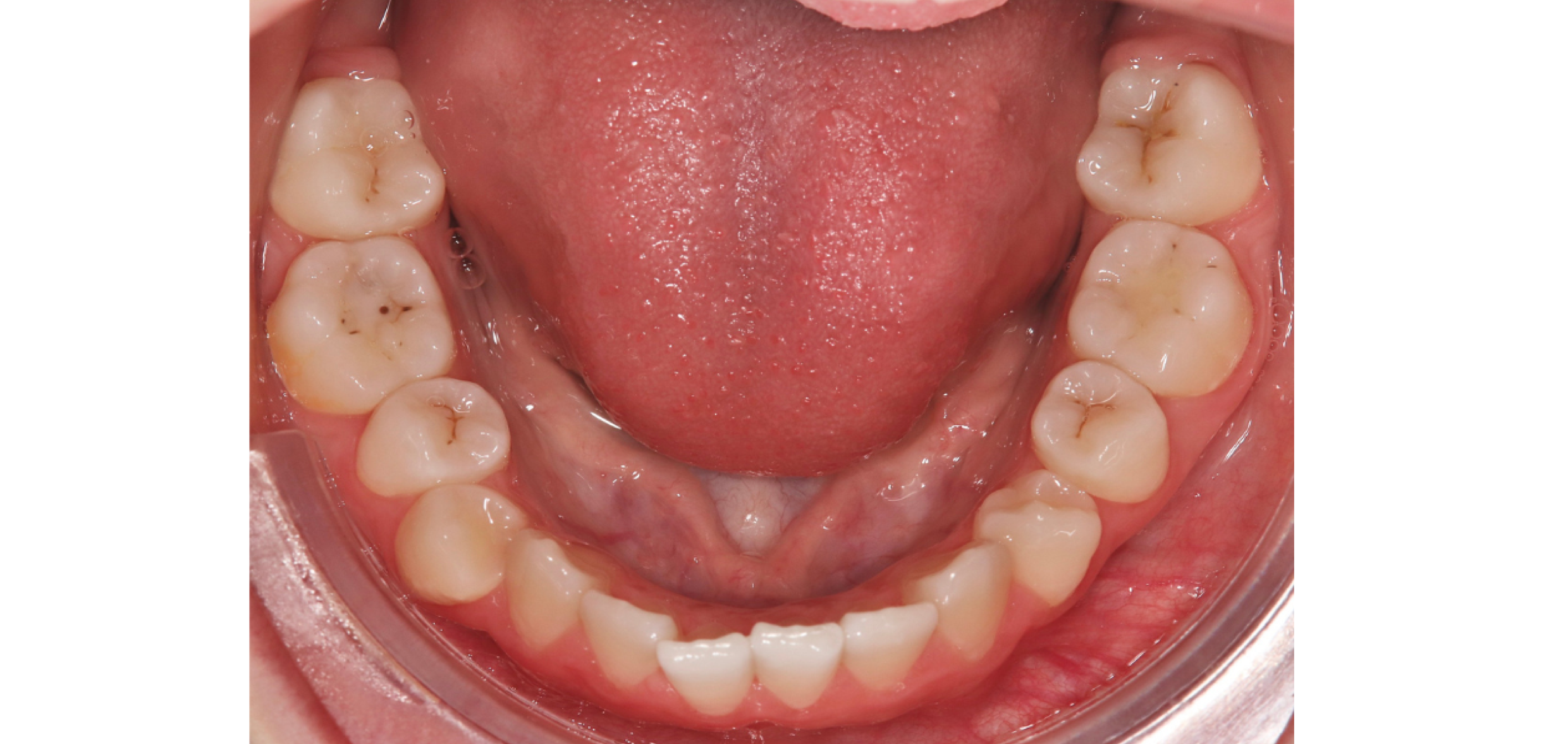 Exemples de cas traités par le Dr Quentin Boison