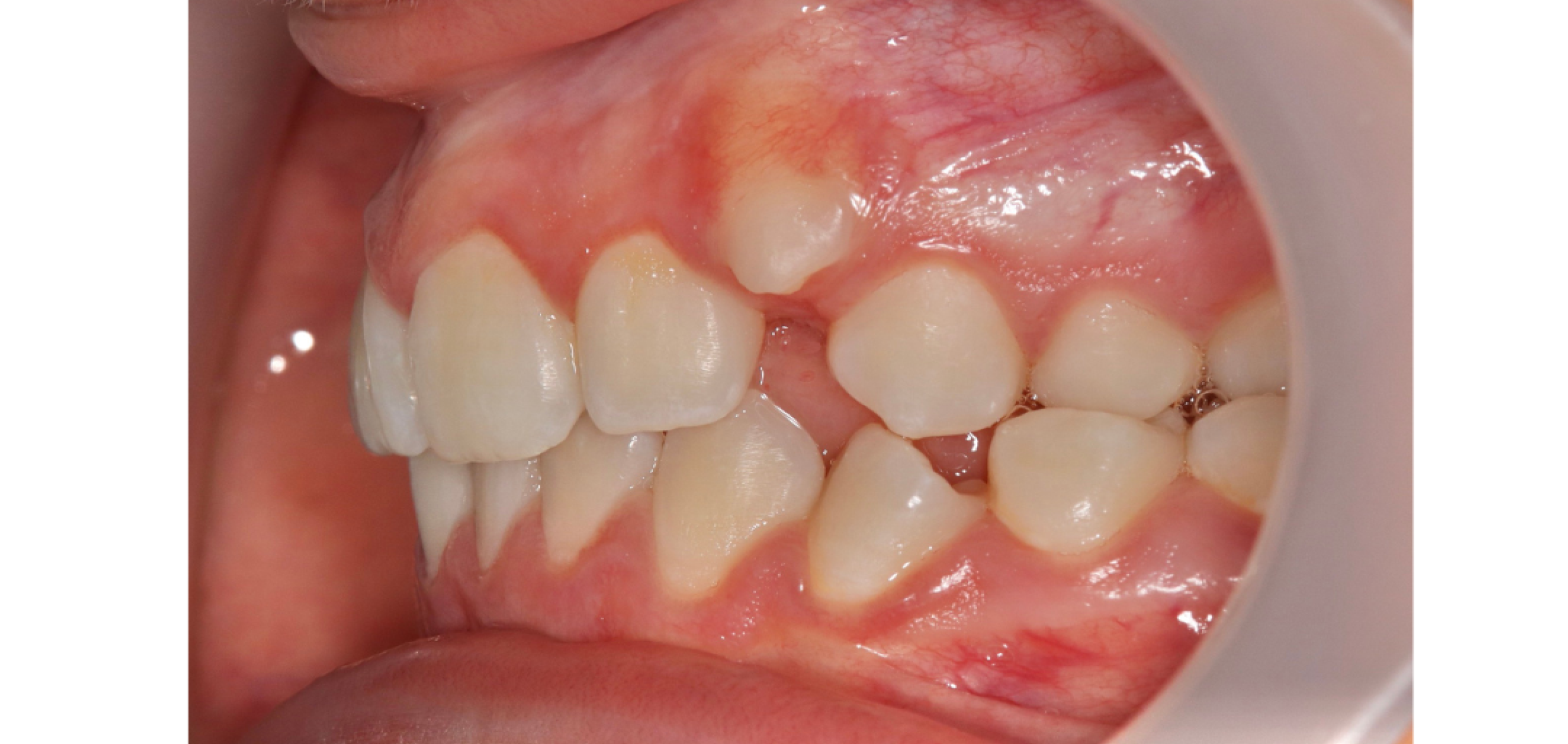 Exemples de cas traités par le Dr Quentin Boison