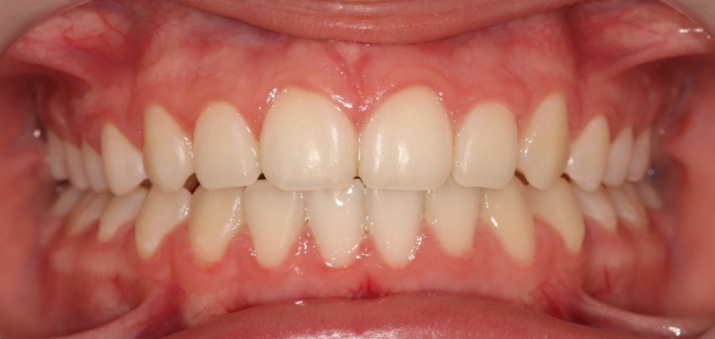 Exemples de cas traités par le Dr Quentin Boison