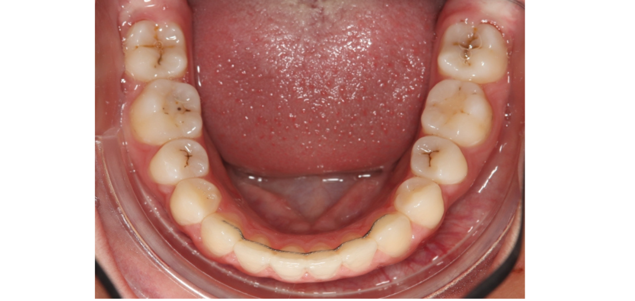 Exemples de cas traités par le Dr Quentin Boison