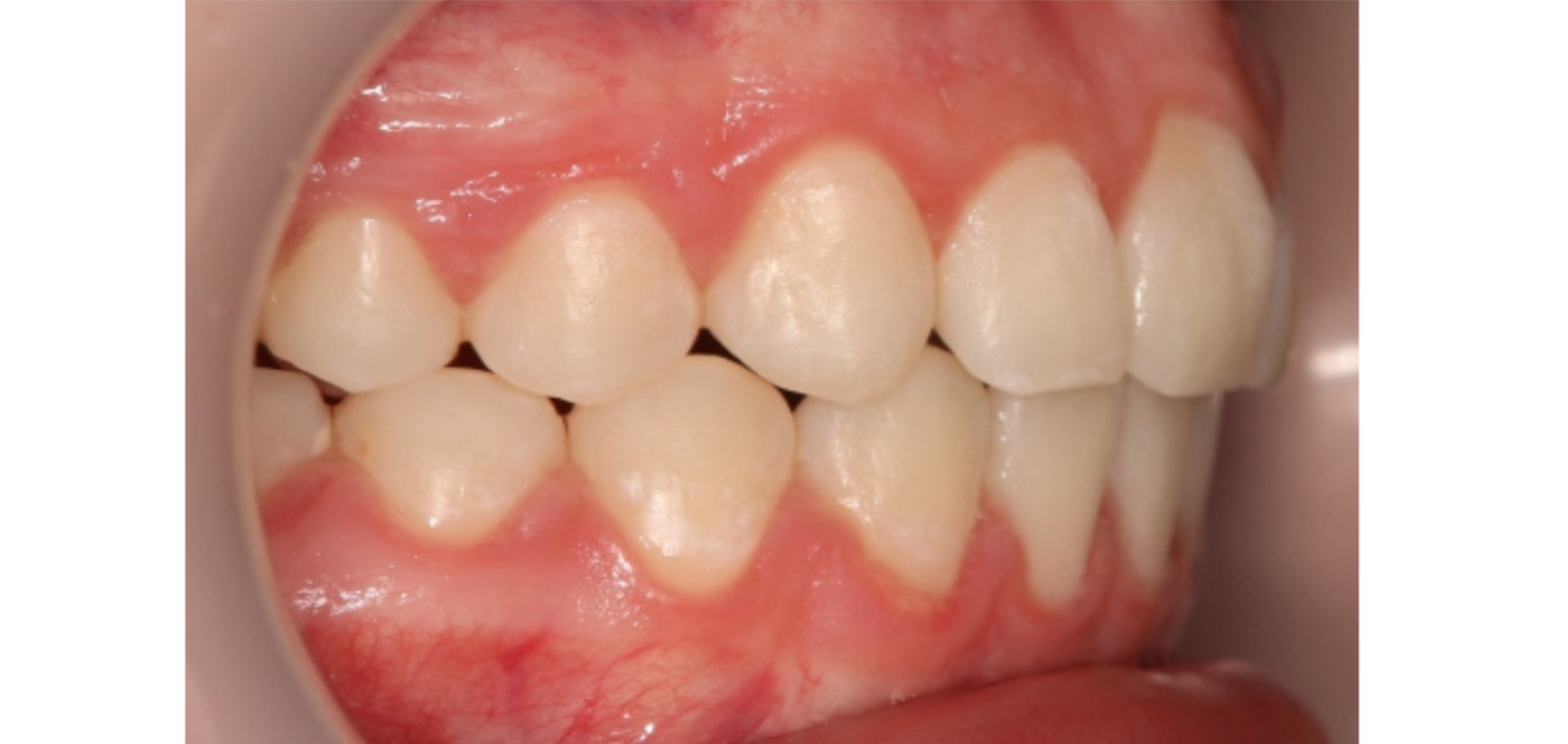 Exemples de cas traités par le Dr Quentin Boison