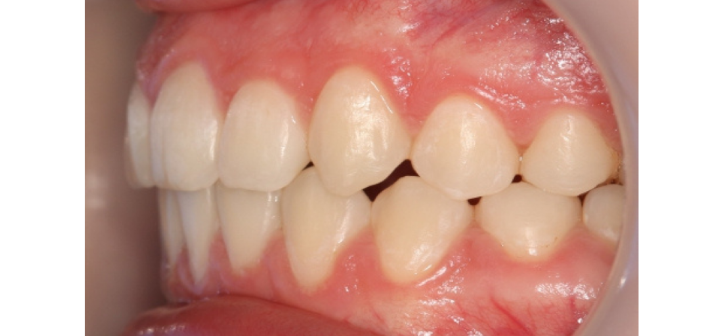 Exemples de cas traités par le Dr Quentin Boison