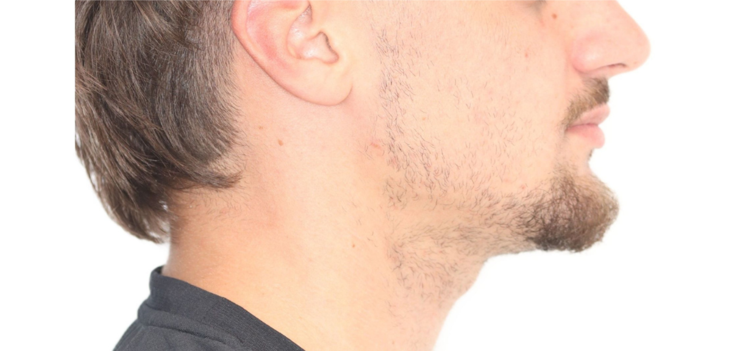 Exemples de cas traités par le Dr Quentin Boison