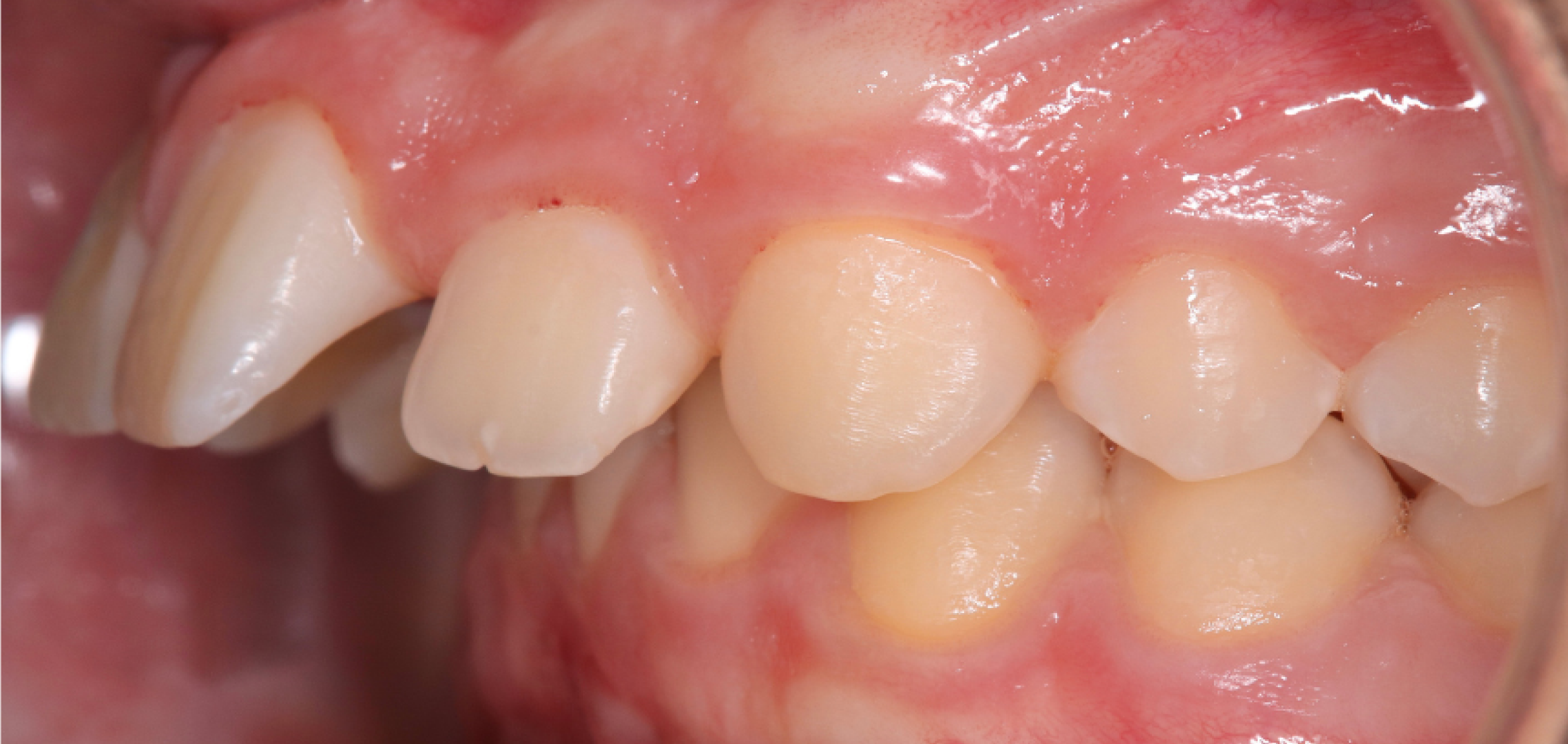 Exemples de cas traités par le Dr Quentin Boison