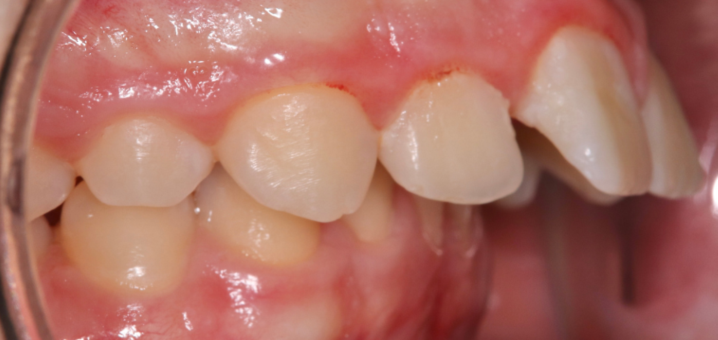 Exemples de cas traités par le Dr Quentin Boison