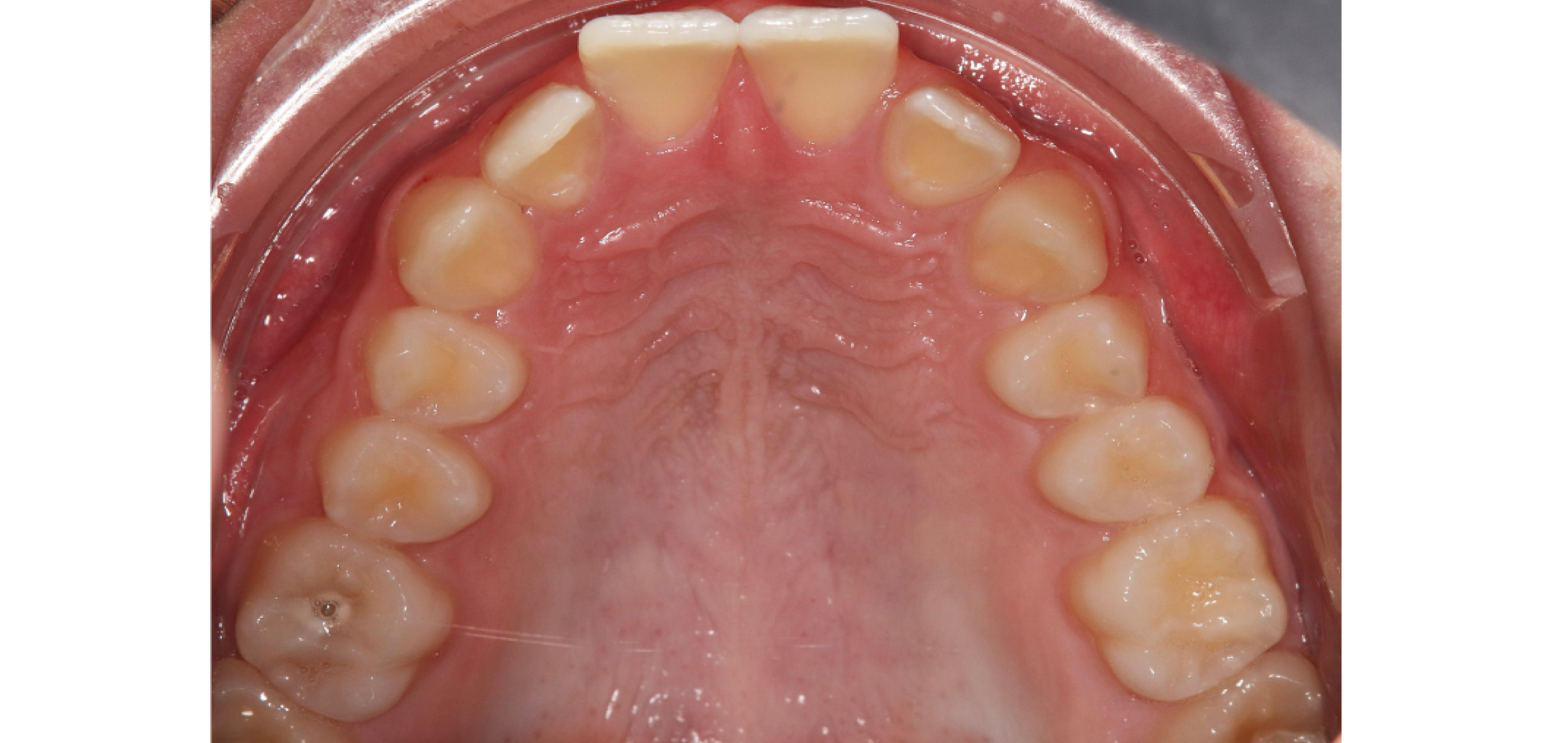 Exemples de cas traités par le Dr Quentin Boison