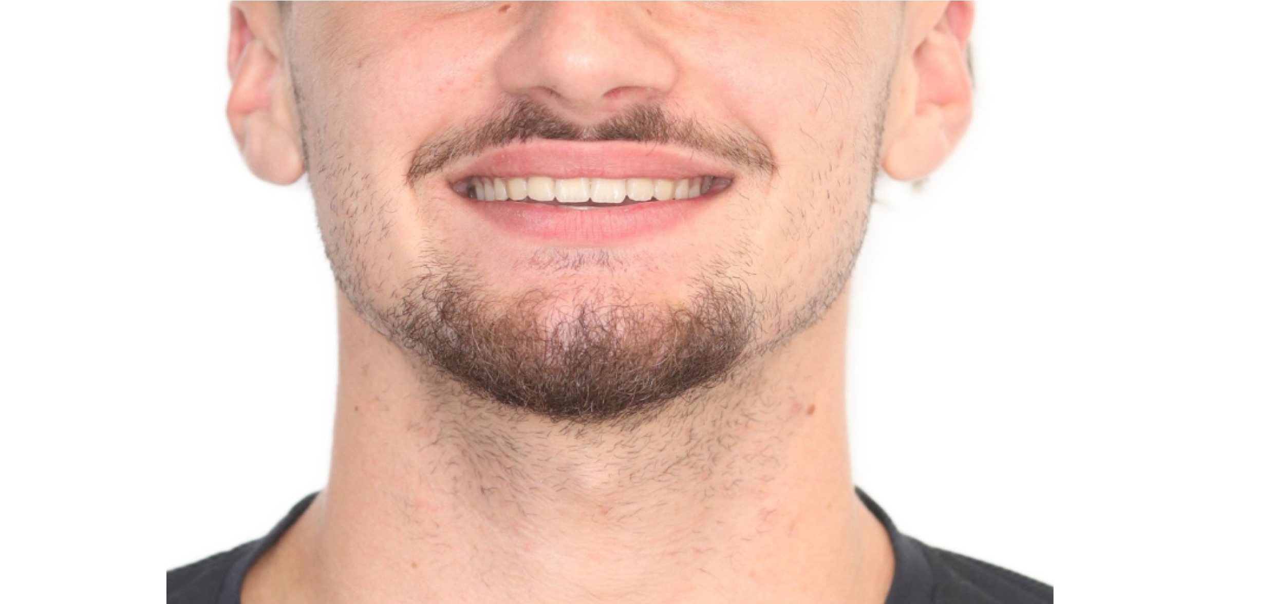 Exemples de cas traités par le Dr Quentin Boison