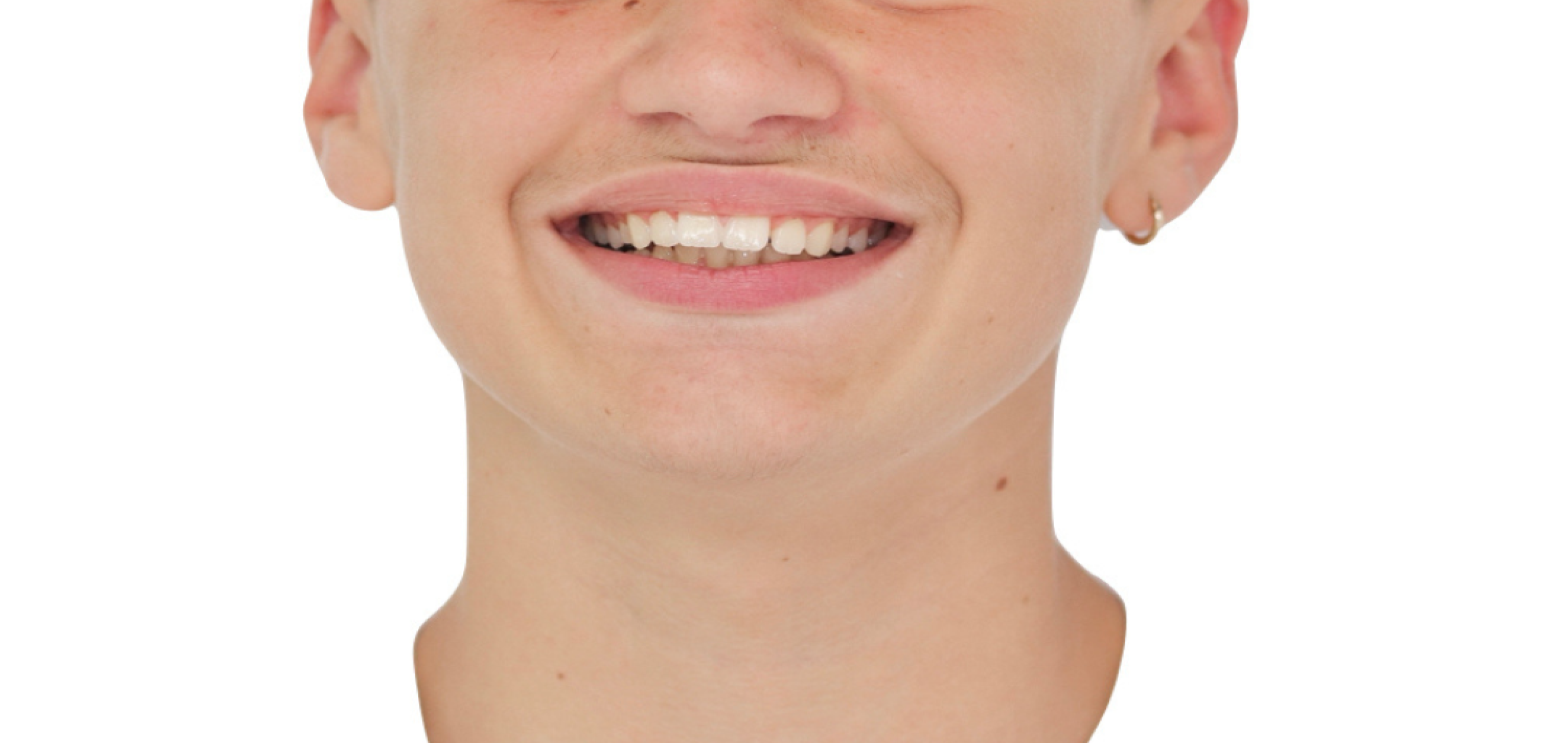 Exemples de cas traités par le Dr Quentin Boison