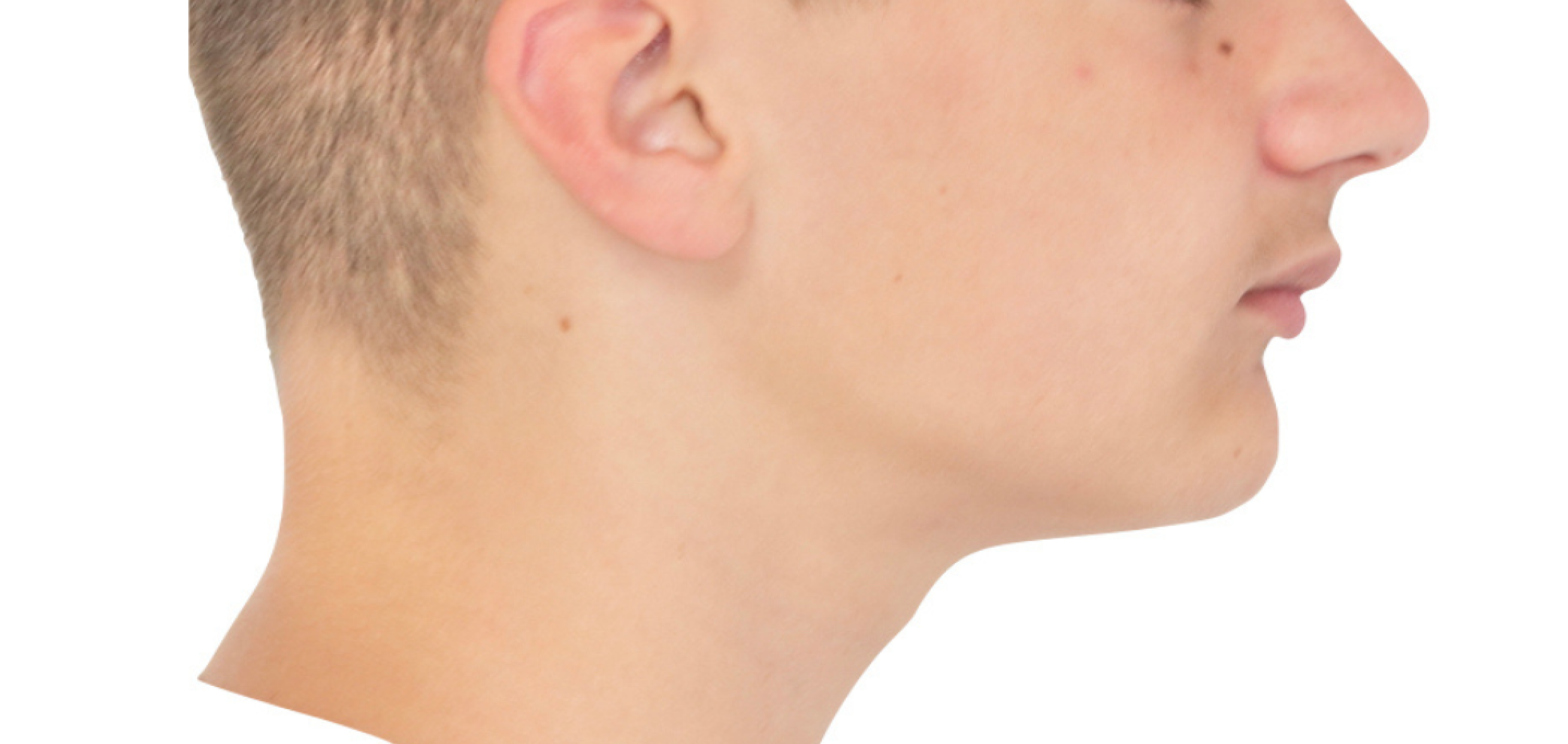 Exemples de cas traités par le Dr Quentin Boison