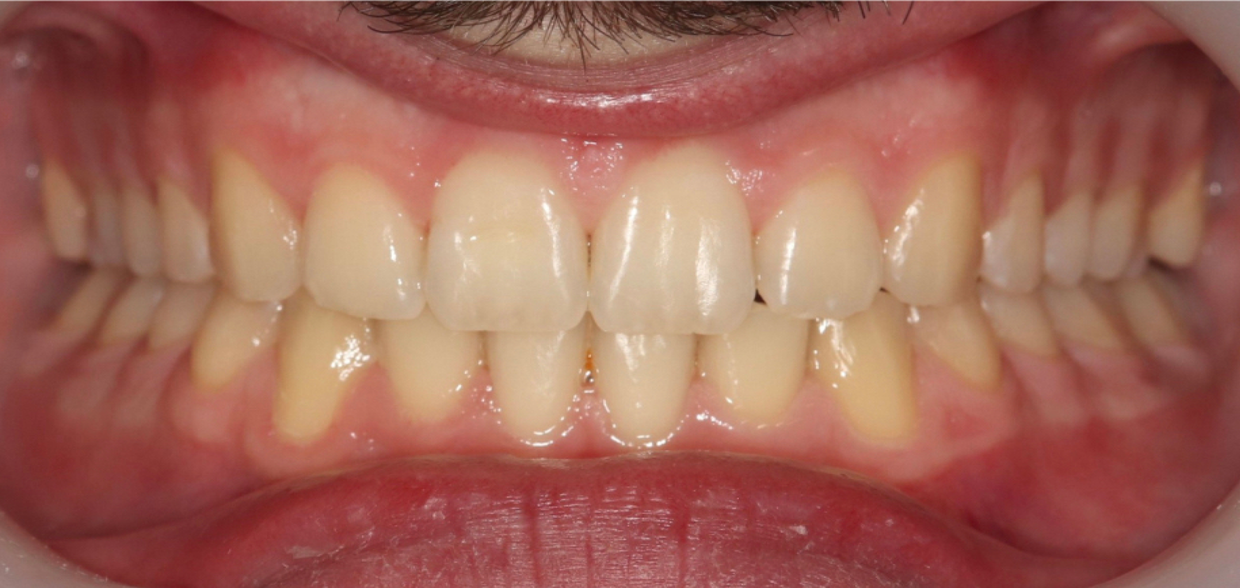 Exemples de cas traités par le Dr Quentin Boison