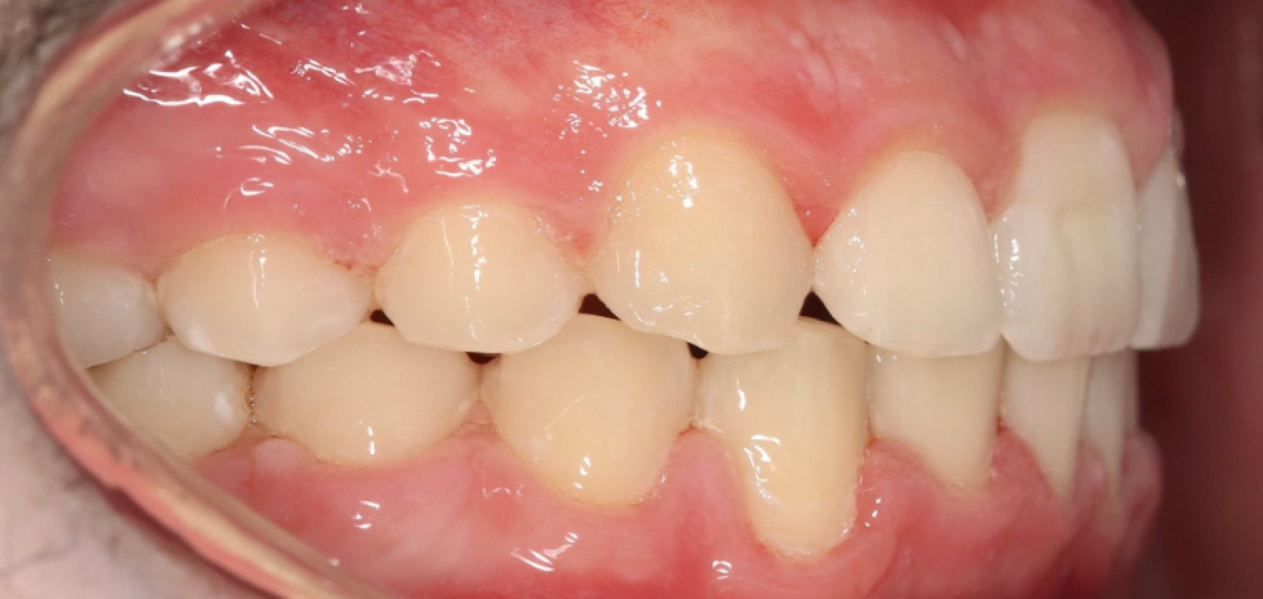 Exemples de cas traités par le Dr Quentin Boison