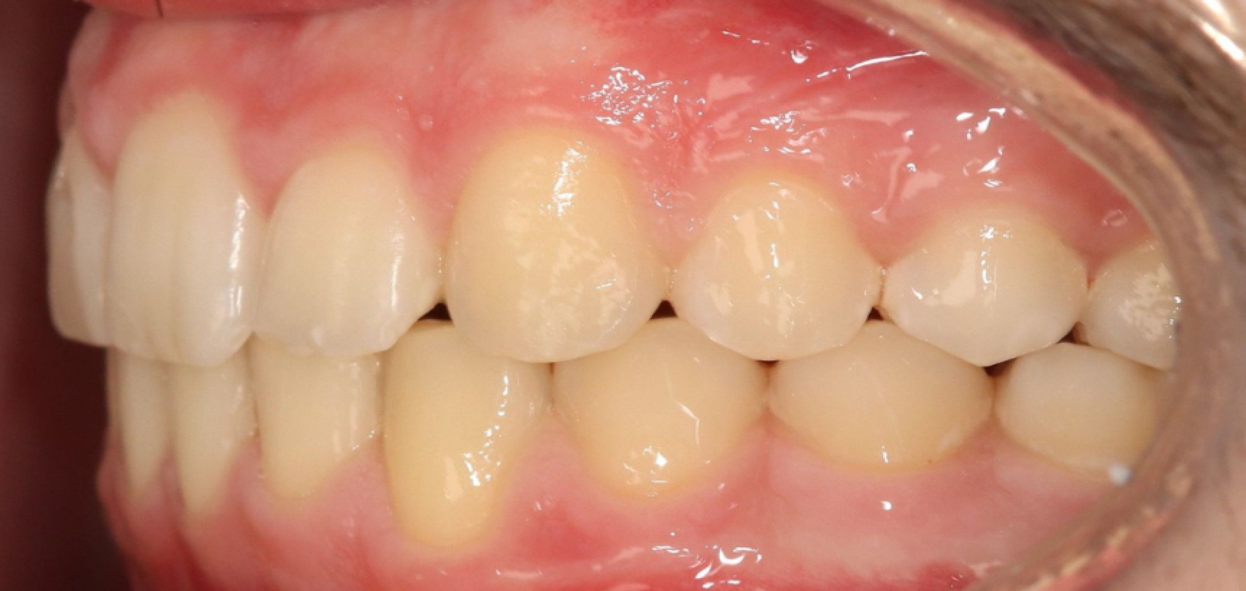 Exemples de cas traités par le Dr Quentin Boison