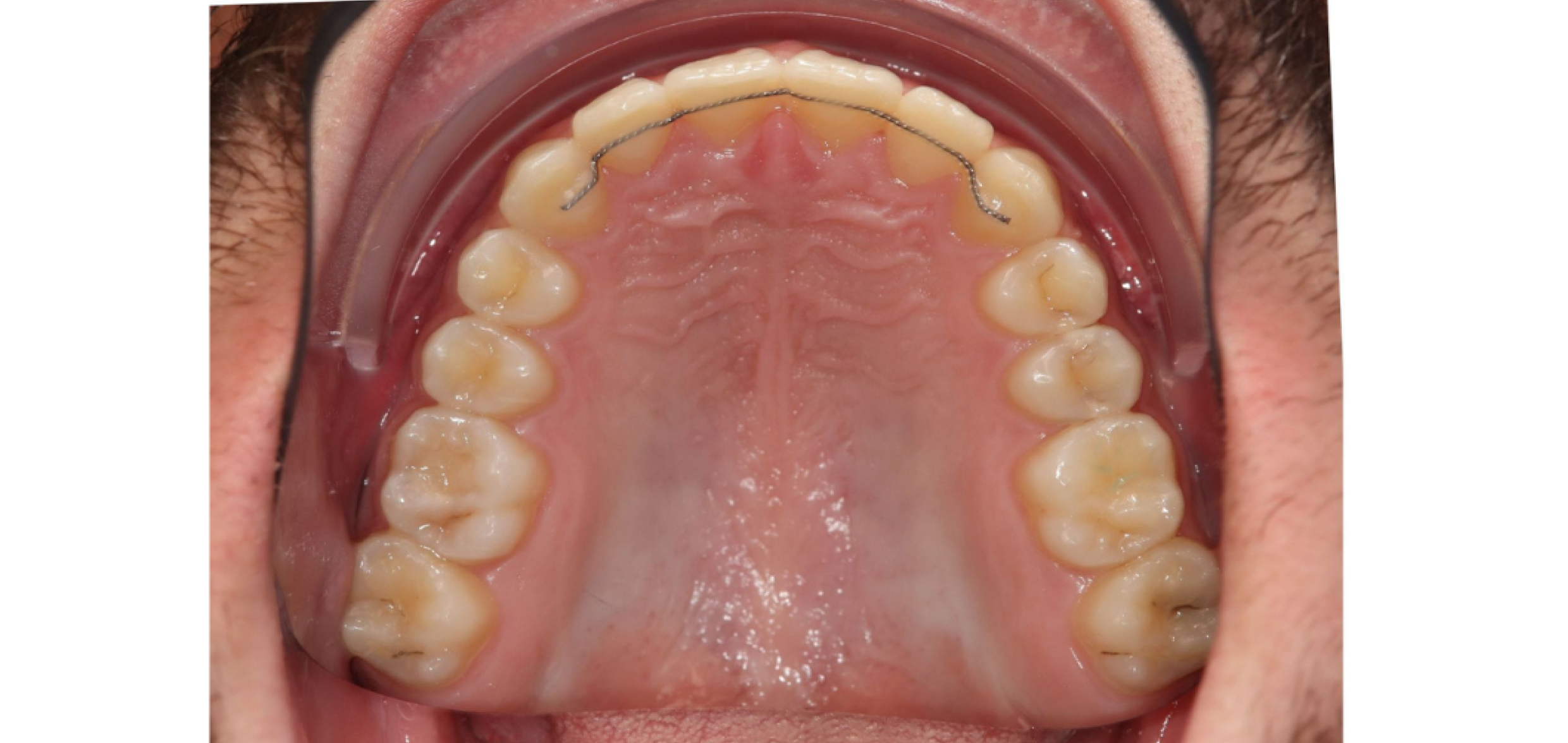 Exemples de cas traités par le Dr Quentin Boison