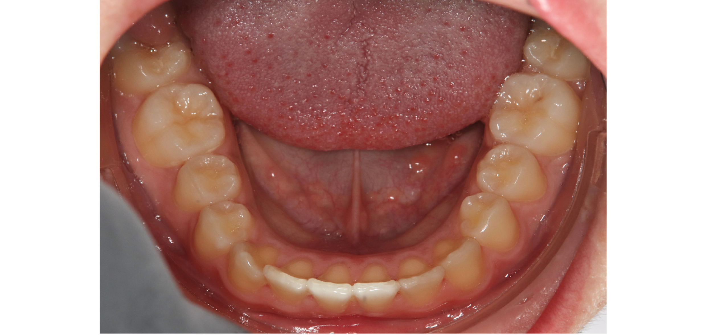 Exemples de cas traités par le Dr Quentin Boison