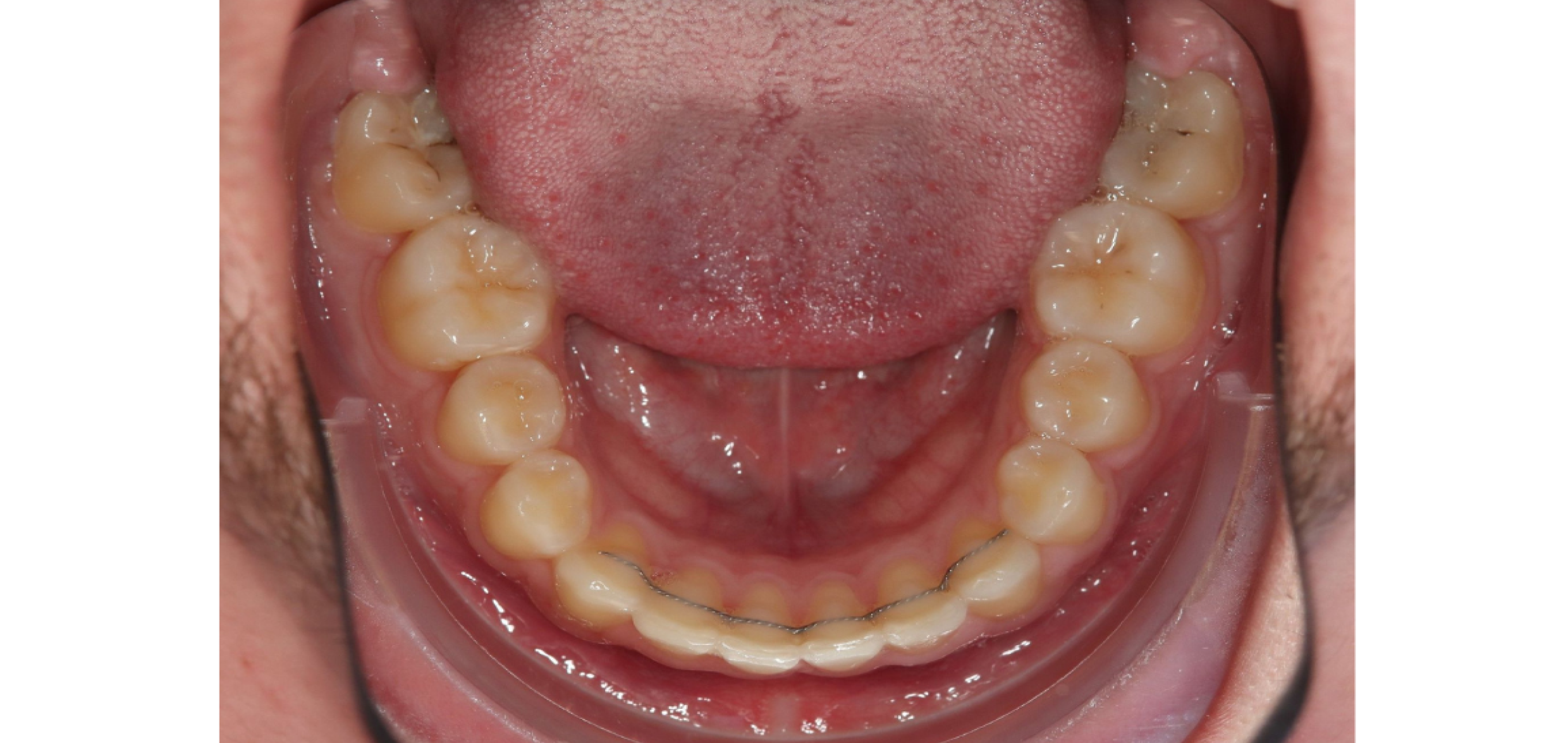 Exemples de cas traités par le Dr Quentin Boison