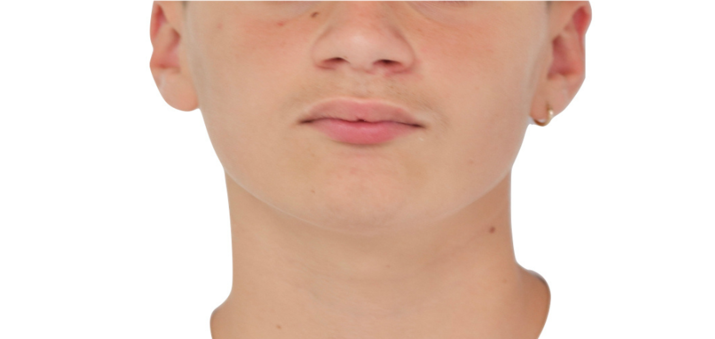 Exemples de cas traités par le Dr Quentin Boison