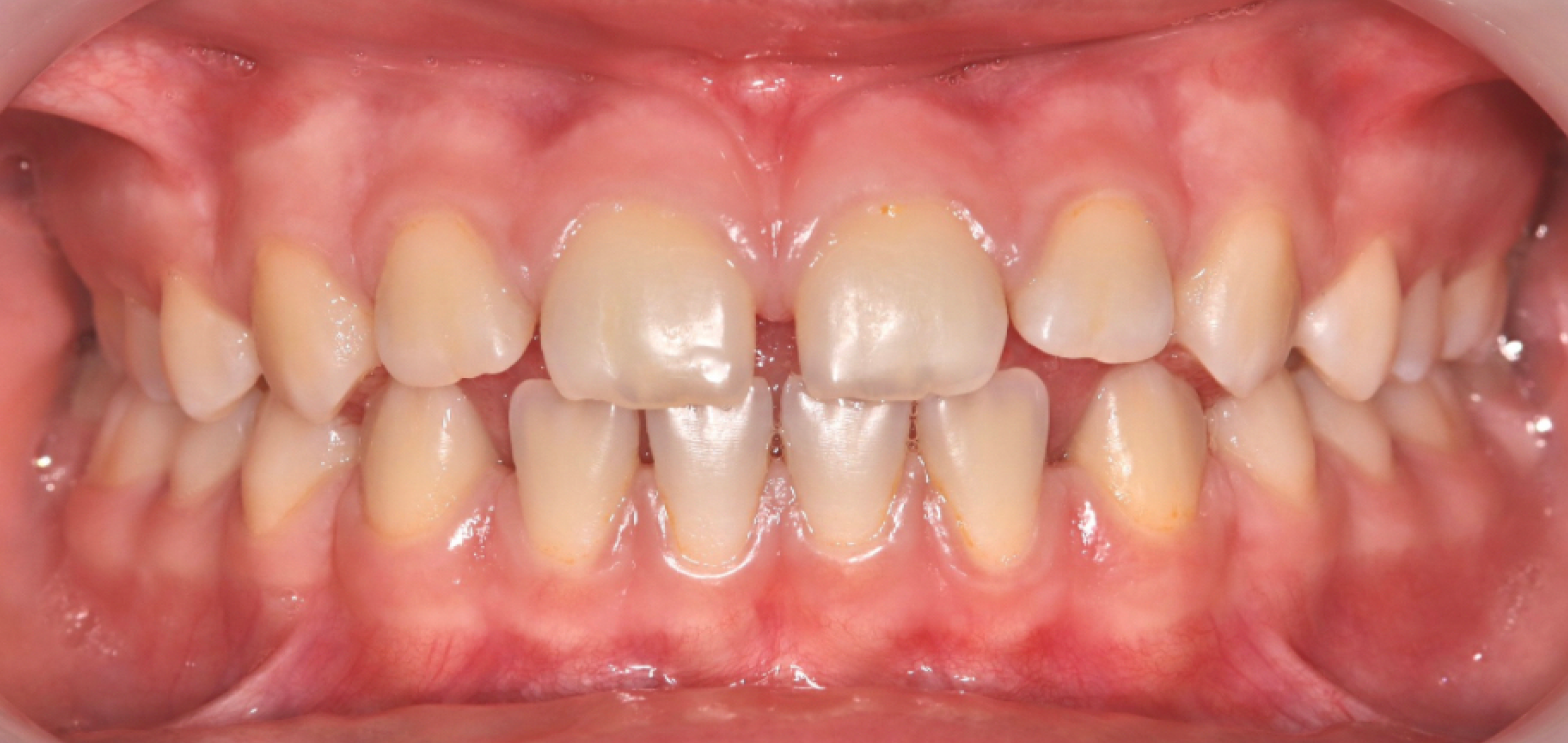 Exemples de cas traités par le Dr Quentin Boison