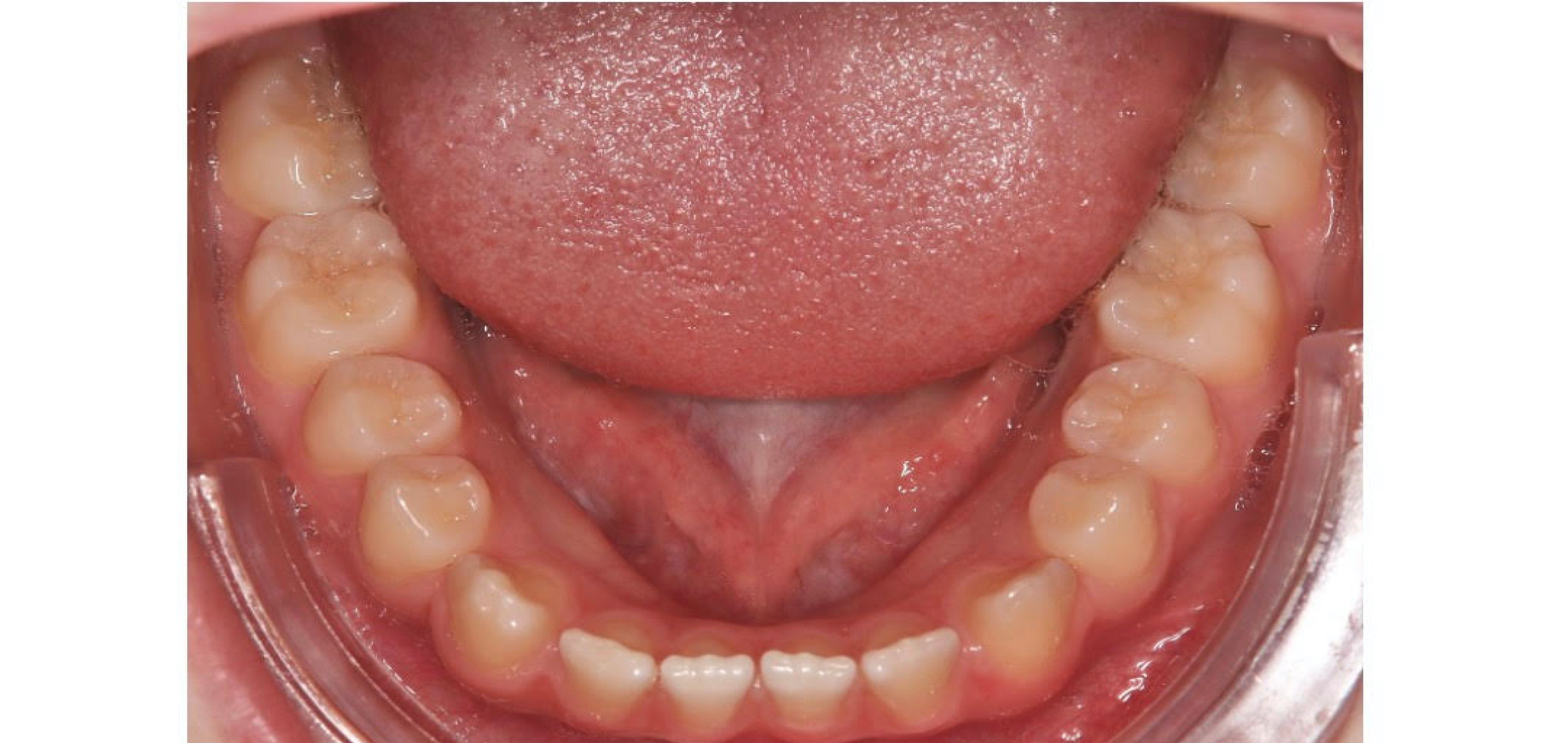 Exemples de cas traités par le Dr Quentin Boison
