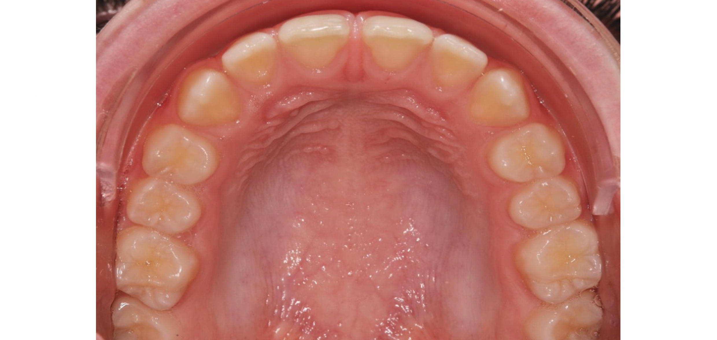 Exemples de cas traités par le Dr Quentin Boison