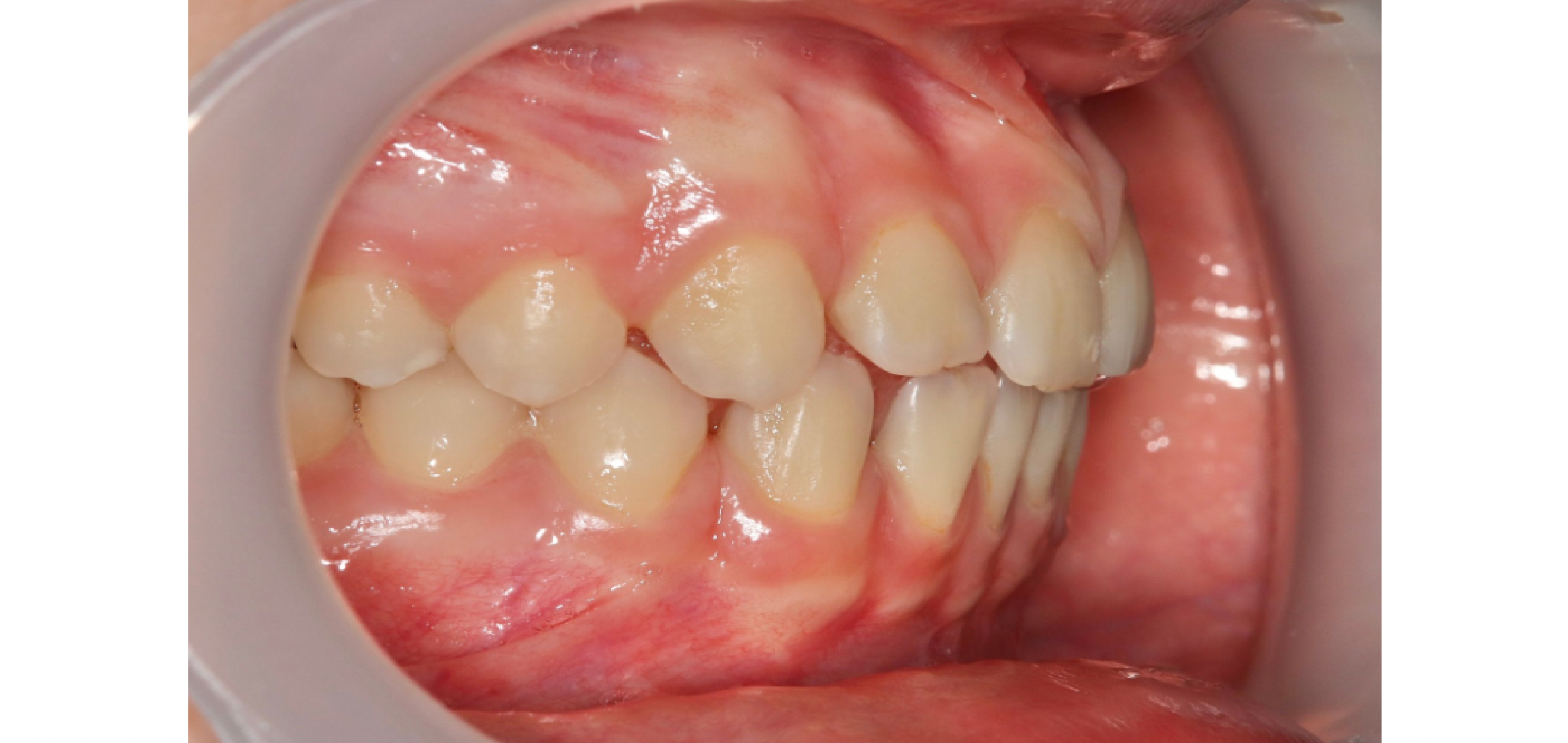 Exemples de cas traités par le Dr Quentin Boison