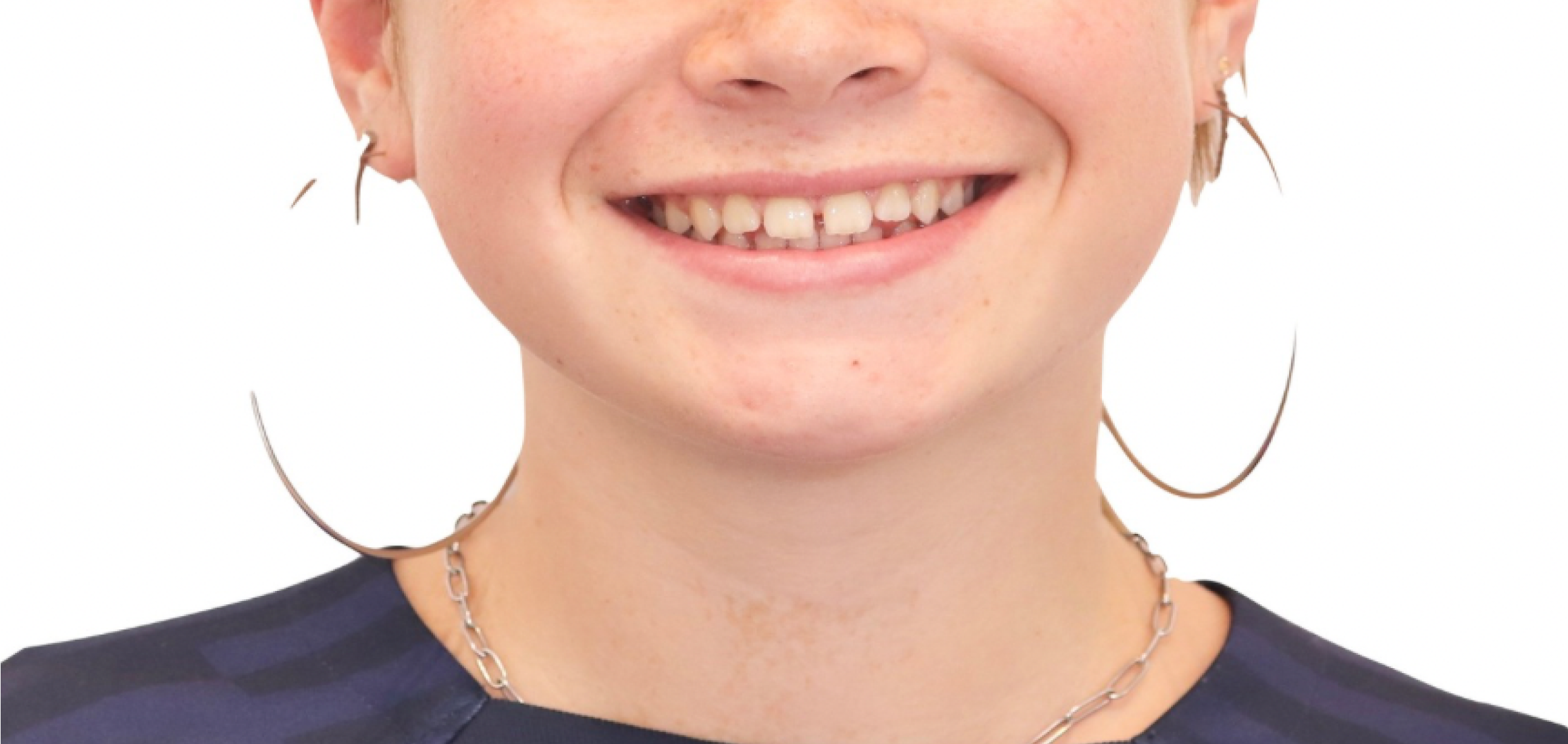 Exemples de cas traités par le Dr Quentin Boison