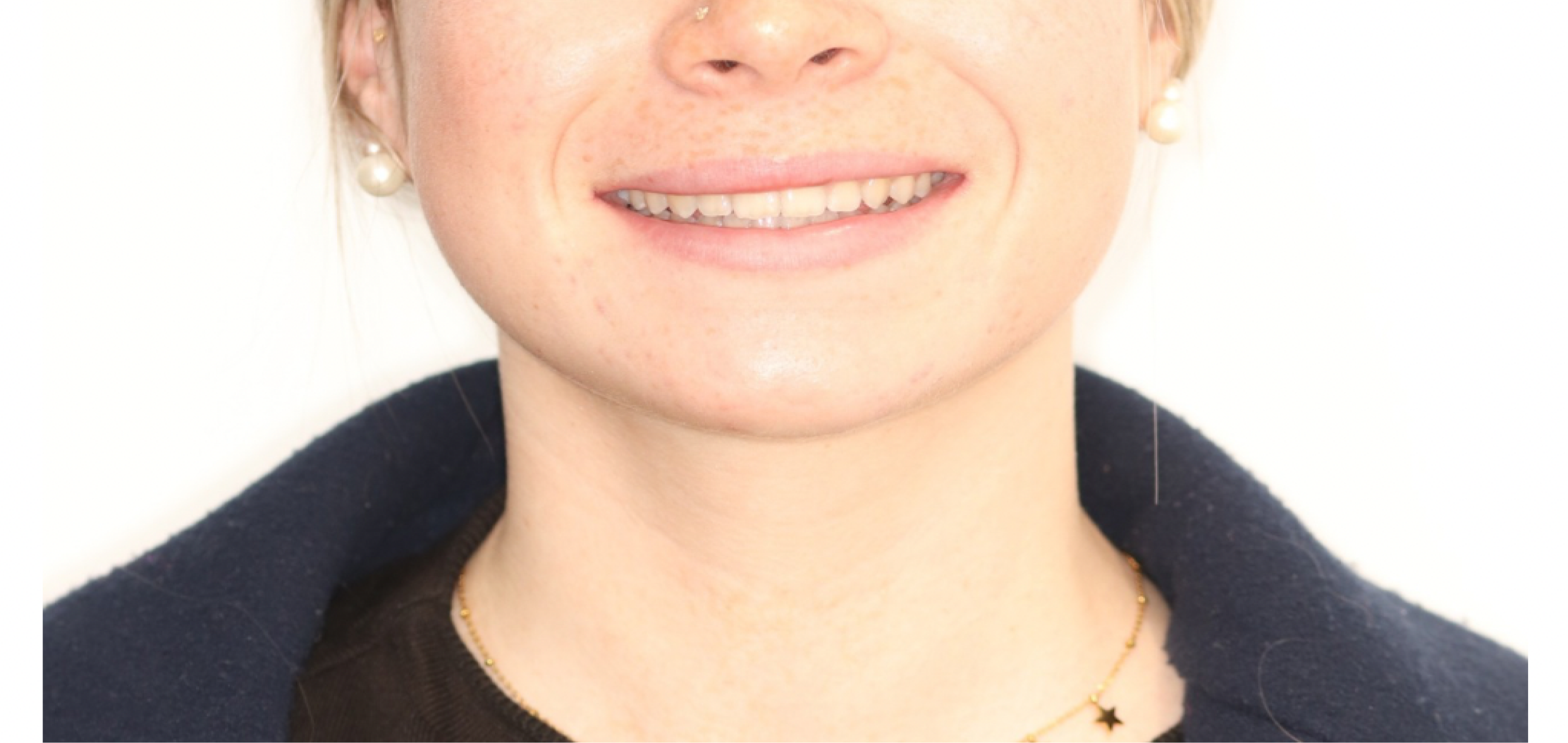 Exemples de cas traités par le Dr Quentin Boison