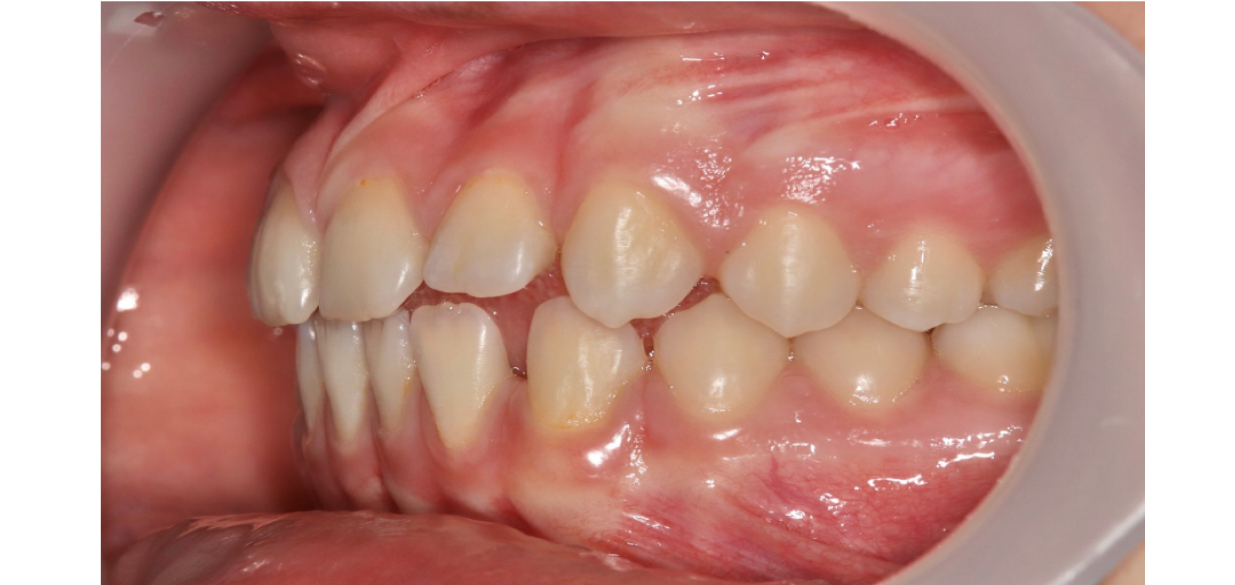 Exemples de cas traités par le Dr Quentin Boison